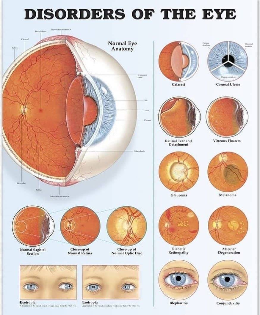 Here's a sampling of anterior segment disease photos from our new