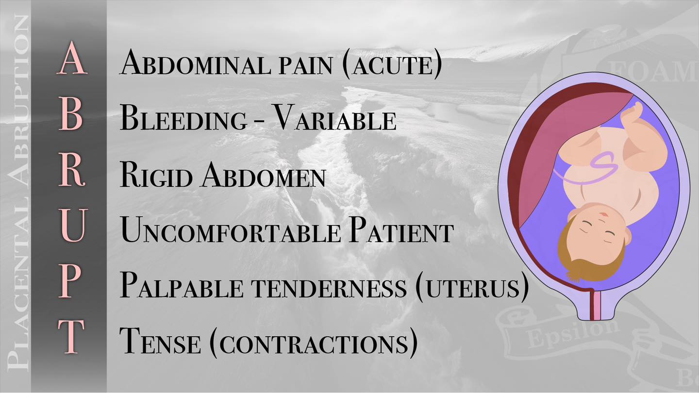 FOAMfrat - The 'typical' placental abruption is said to present with: 1 ...
