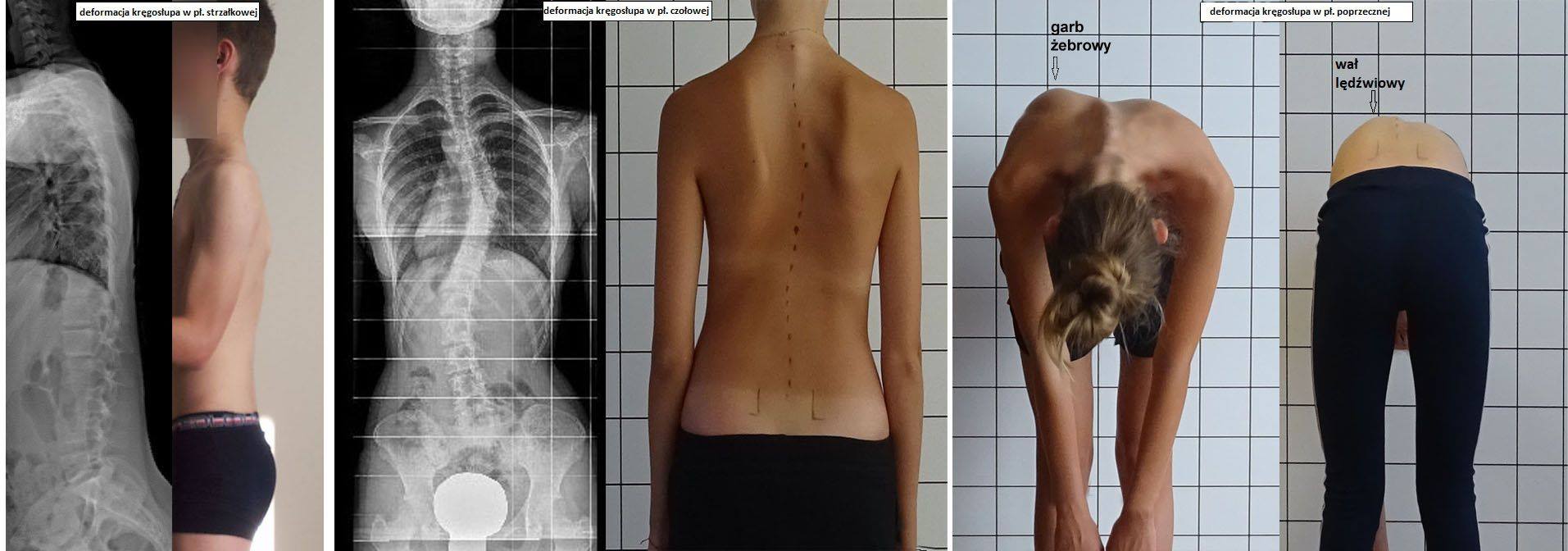 Rehabilitacja niemowląt i dzieci Baby-Reh Sylwia Mazur | Tarnobrzeg