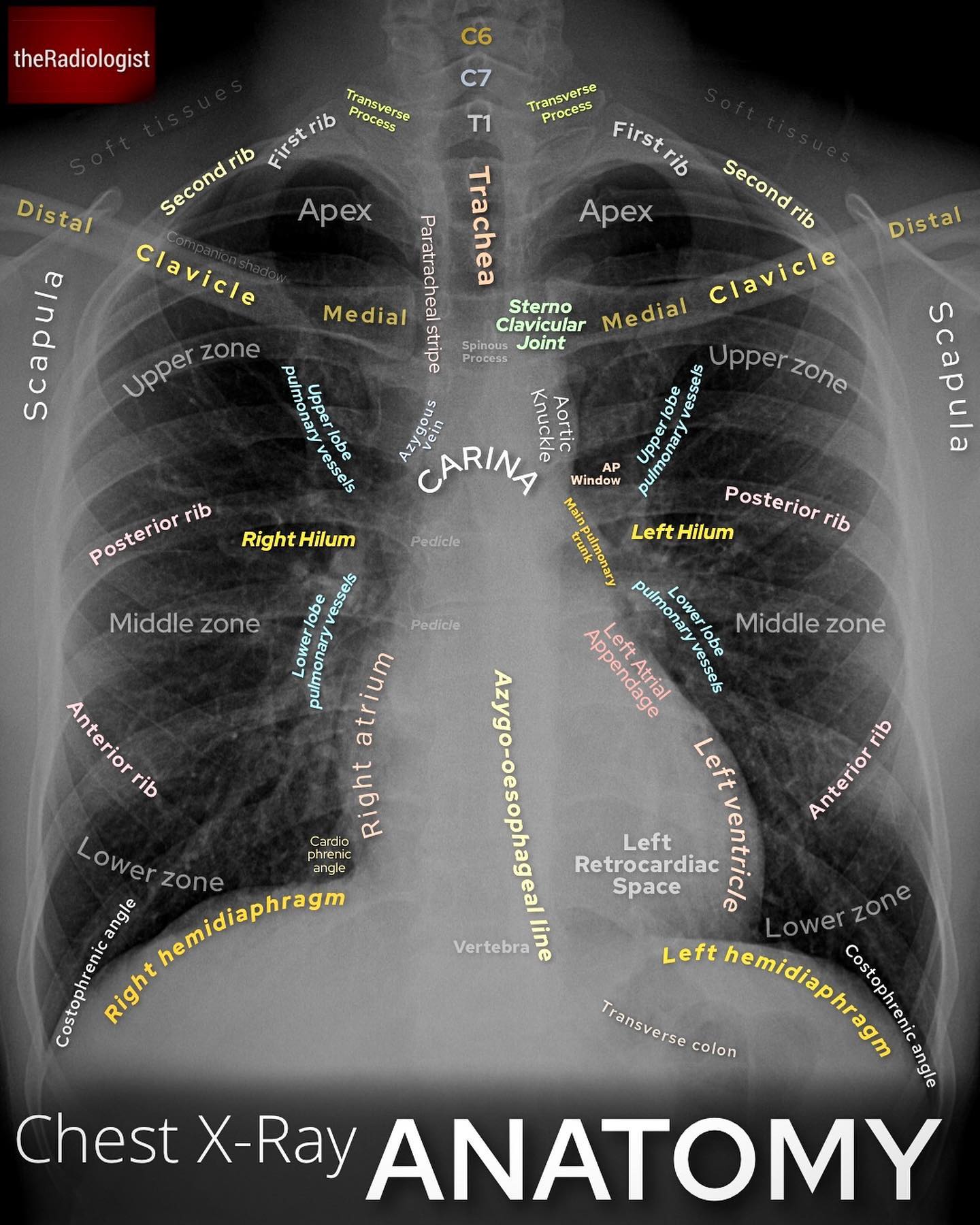 Chest XRay PA projection 🫁 - Dr. Julio Gomez Seco