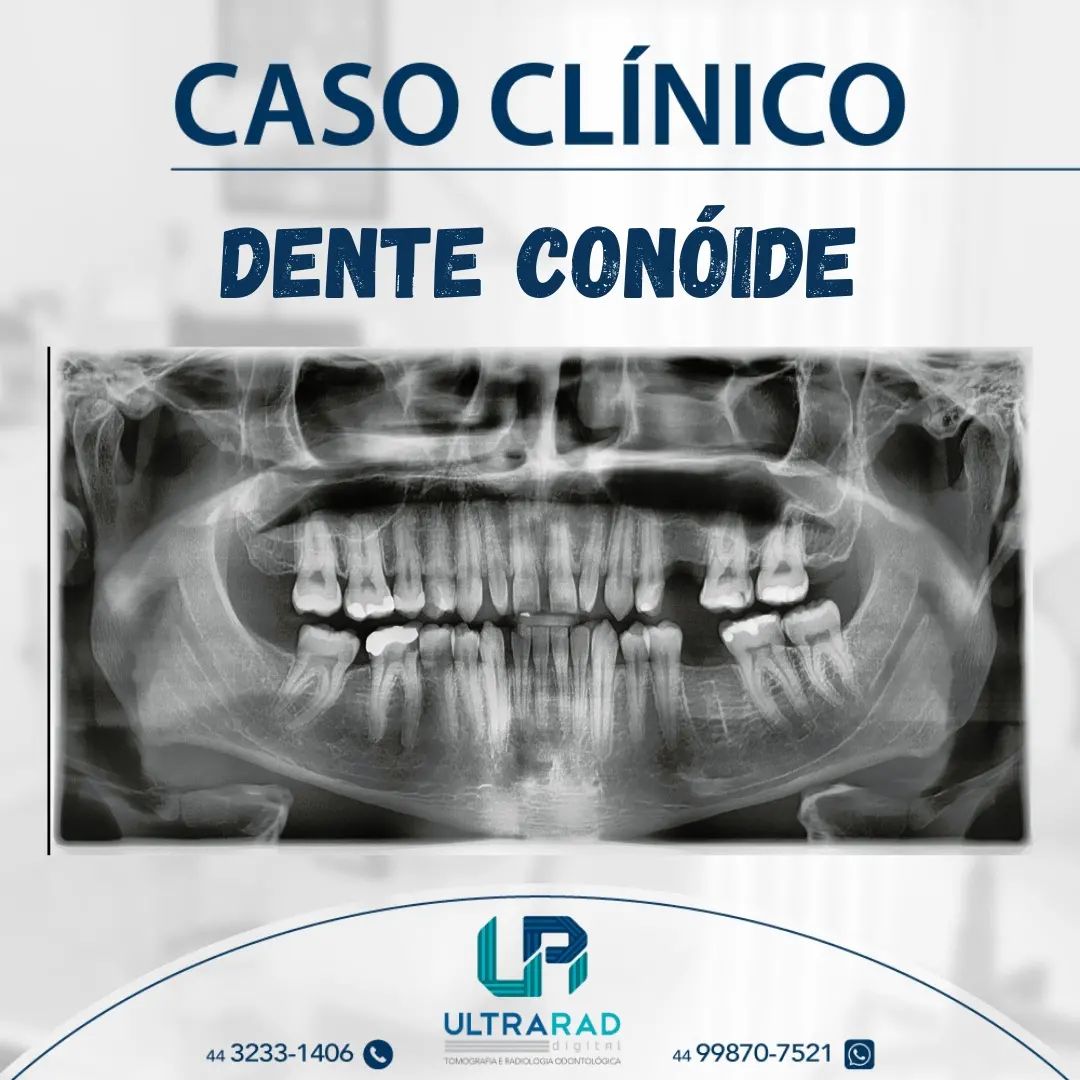 🦷 DENTE... - Ultrarad - Radiologia Odontológica Digital