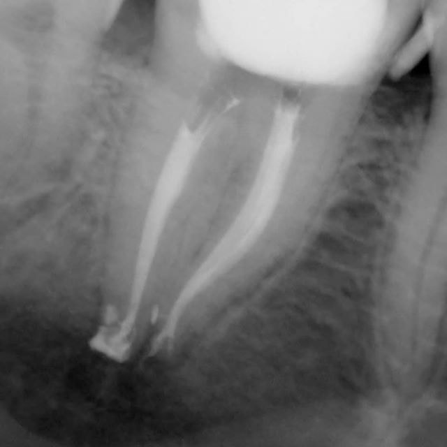 Victor Endodontics, PLLC - 