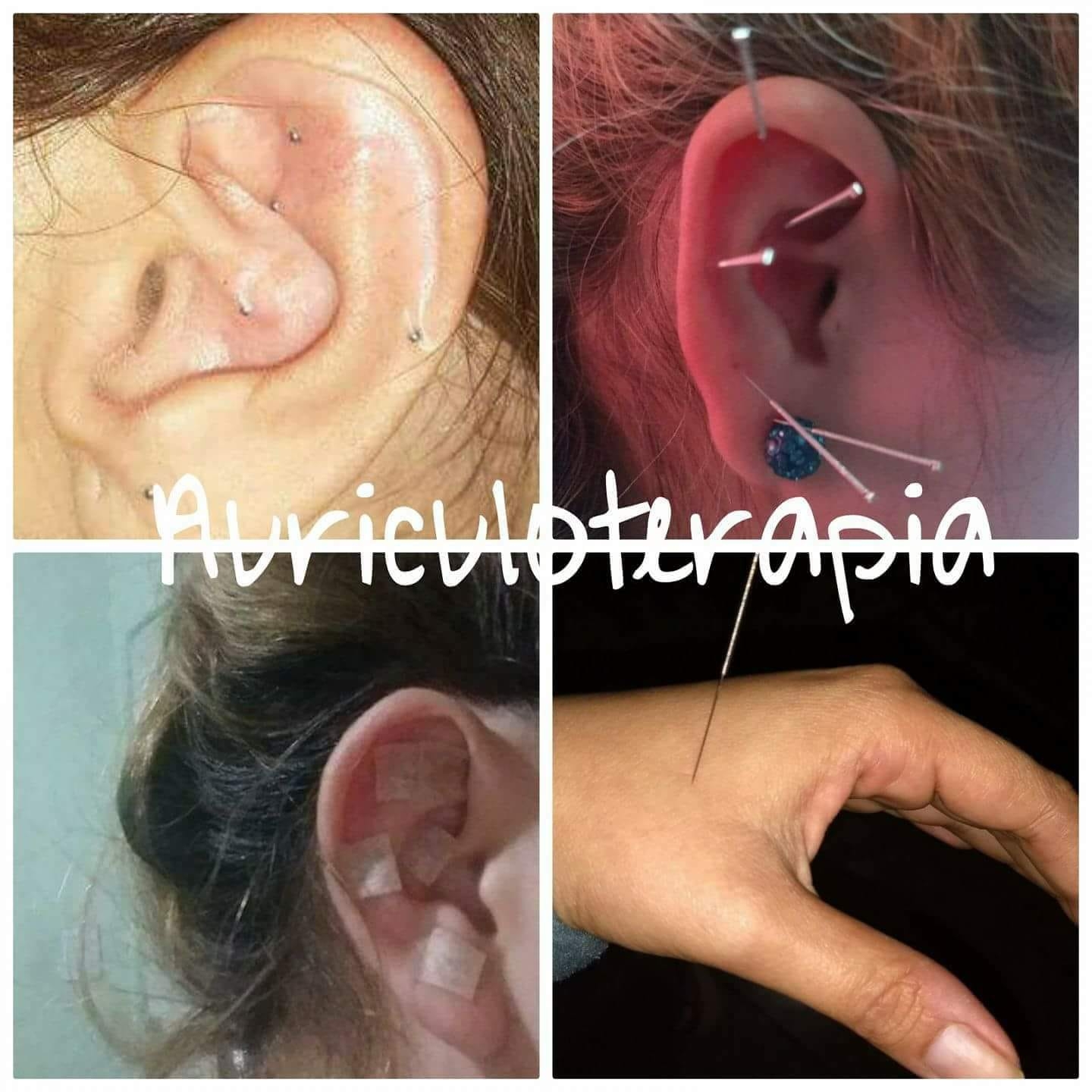 Auriculoterapia - Tendencia Sana - La Aurículoterapia (ó ...