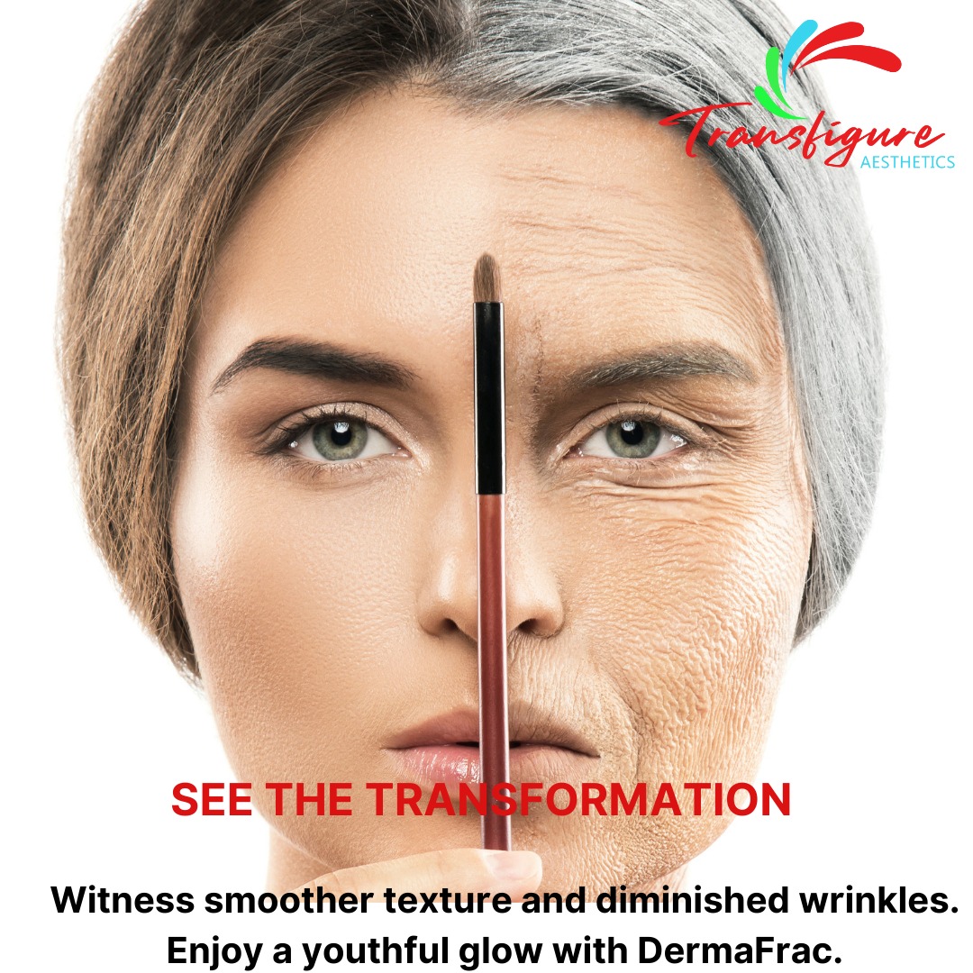 🌟 Unveil a smoother, more refined... - Transfigure_Aesthetics