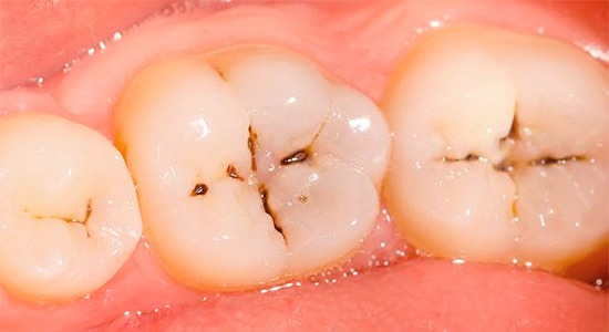 Oral health تەندروستی دەم و ددان | Malmö