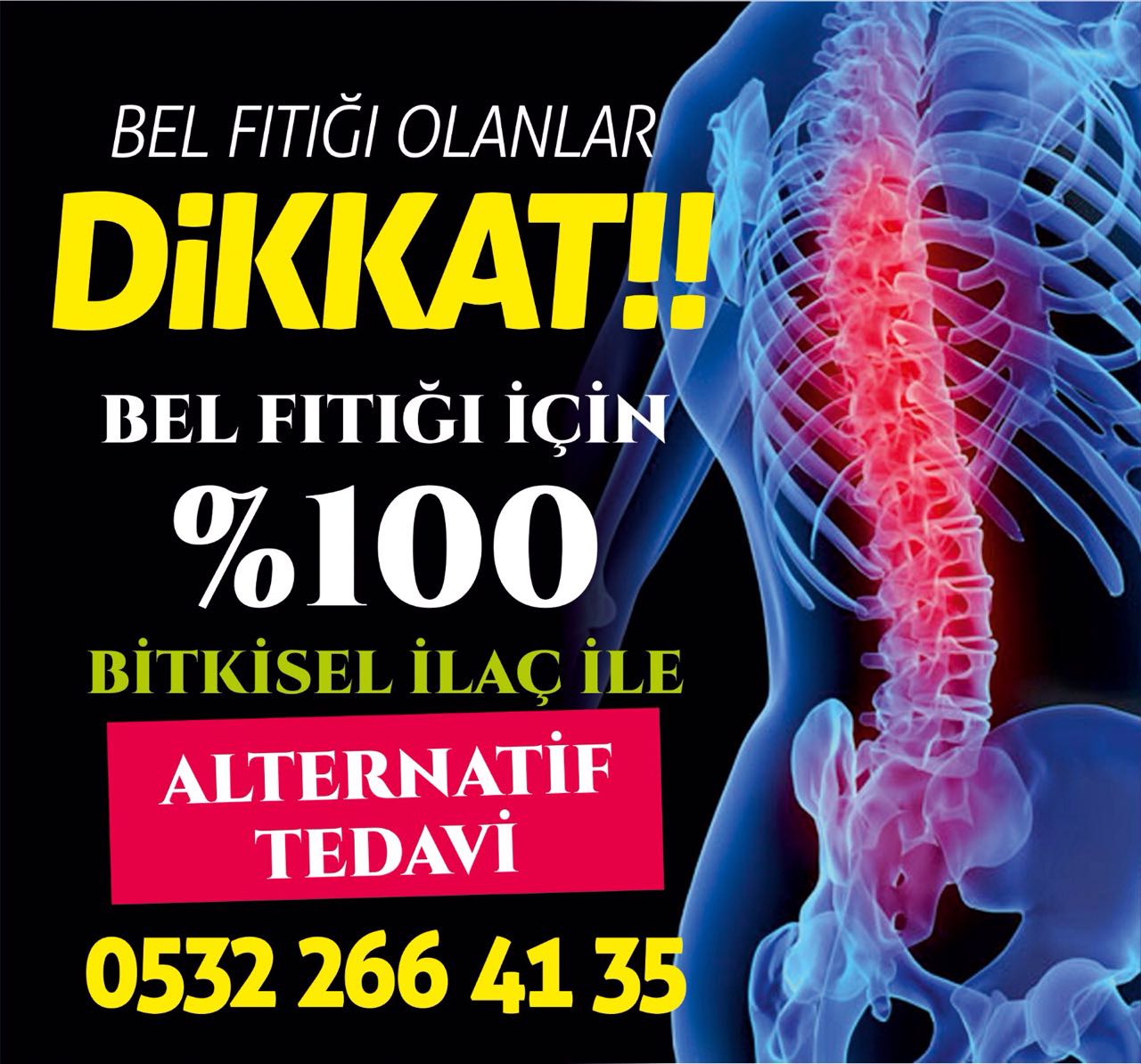 Bel ve Boyun Fıtığına Doğal Tedavi - Anadolu'da yüzyıllardır fıtık ve ...