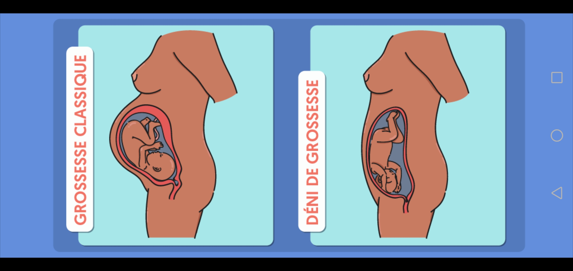 Rever De Faire Un Deni De Grossesse