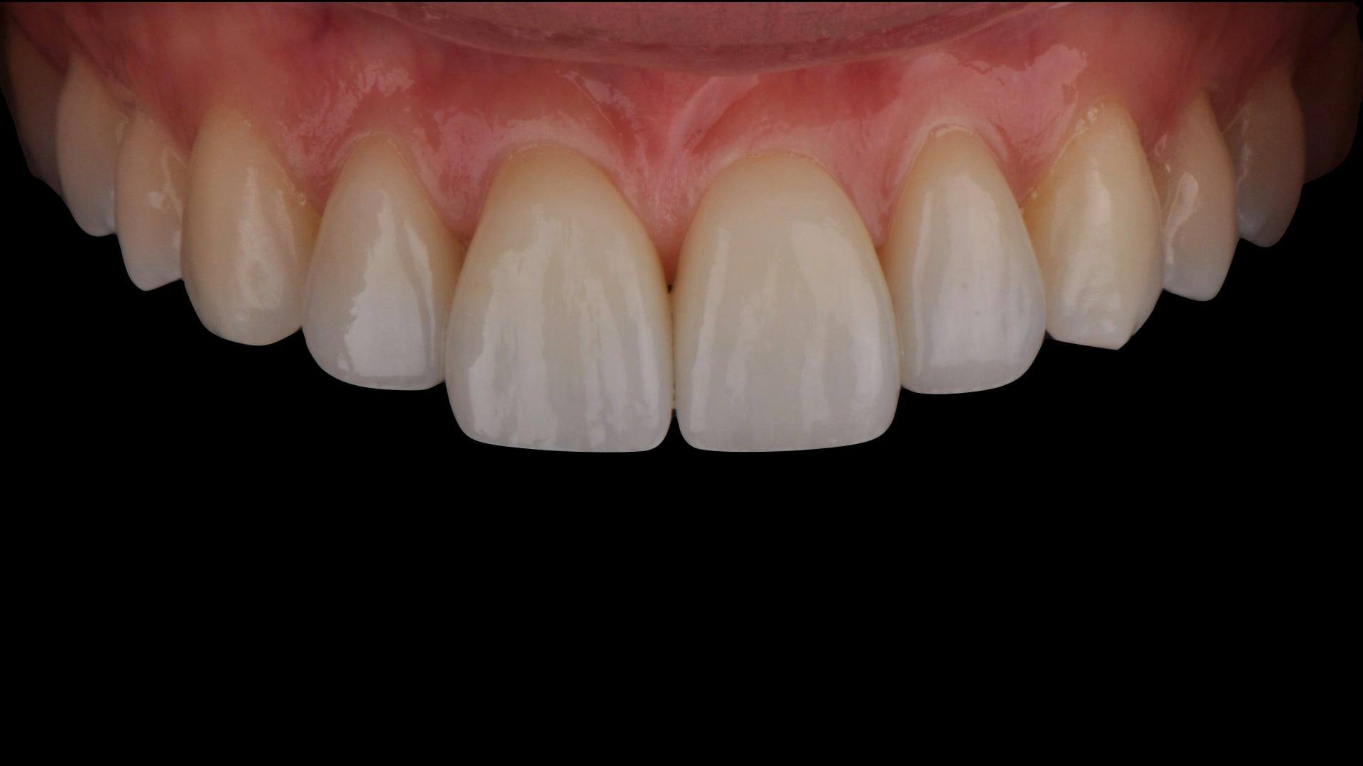 Dental Spring Laboratorio Odontotecnico | Florence