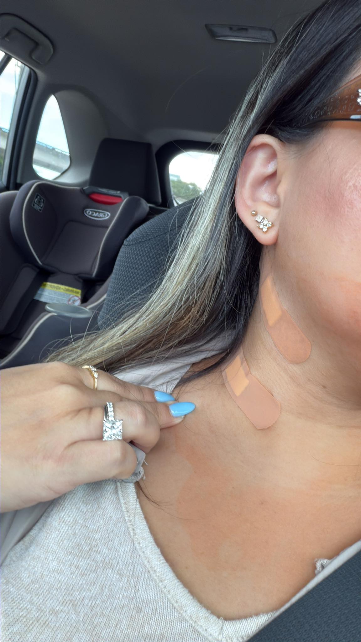 Anyone had enlarged lymphnode in supraclavicular area after tirzepatide shots?