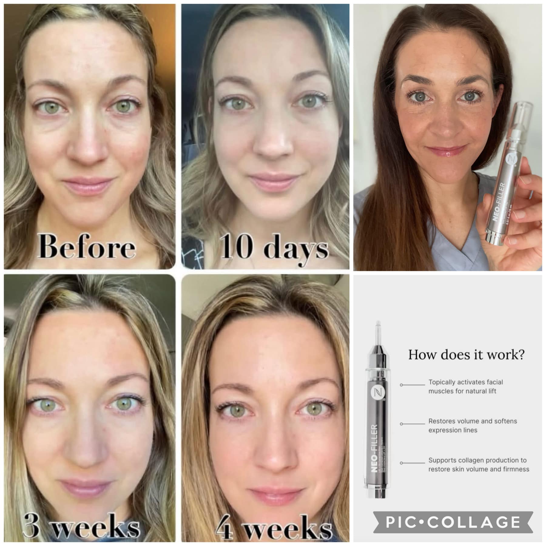 Skin volume has entered the chat 💬 Garnering interest on social