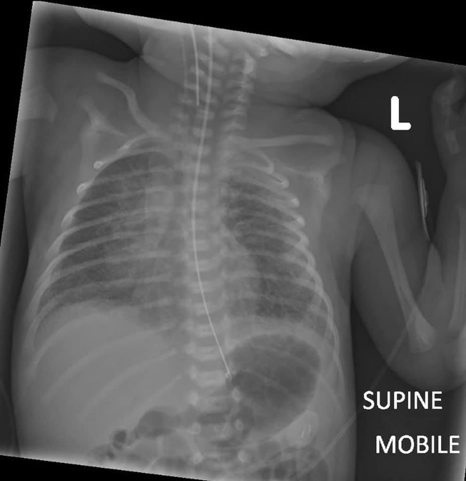 Radiology Insight added a new photo. - Radiology Insight