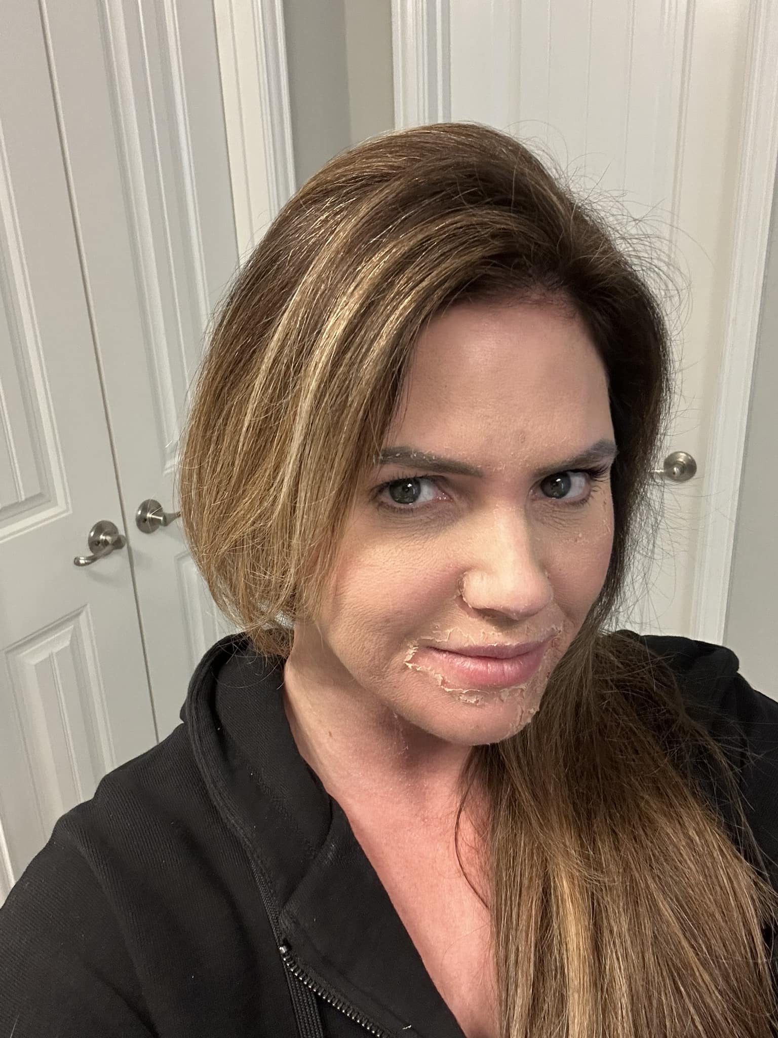 Skin problem solved with The Perfect Derma™ Peel 𝗛𝗮𝘆𝗹𝗶𝗲 𝗟𝗲𝗖𝗹𝗮𝗶𝗿 || Wichita Holistic Aesthetician+Acne Specialist . . #peel #chemicalpeel #glutathione #medicalgrade #hyperpigmentation