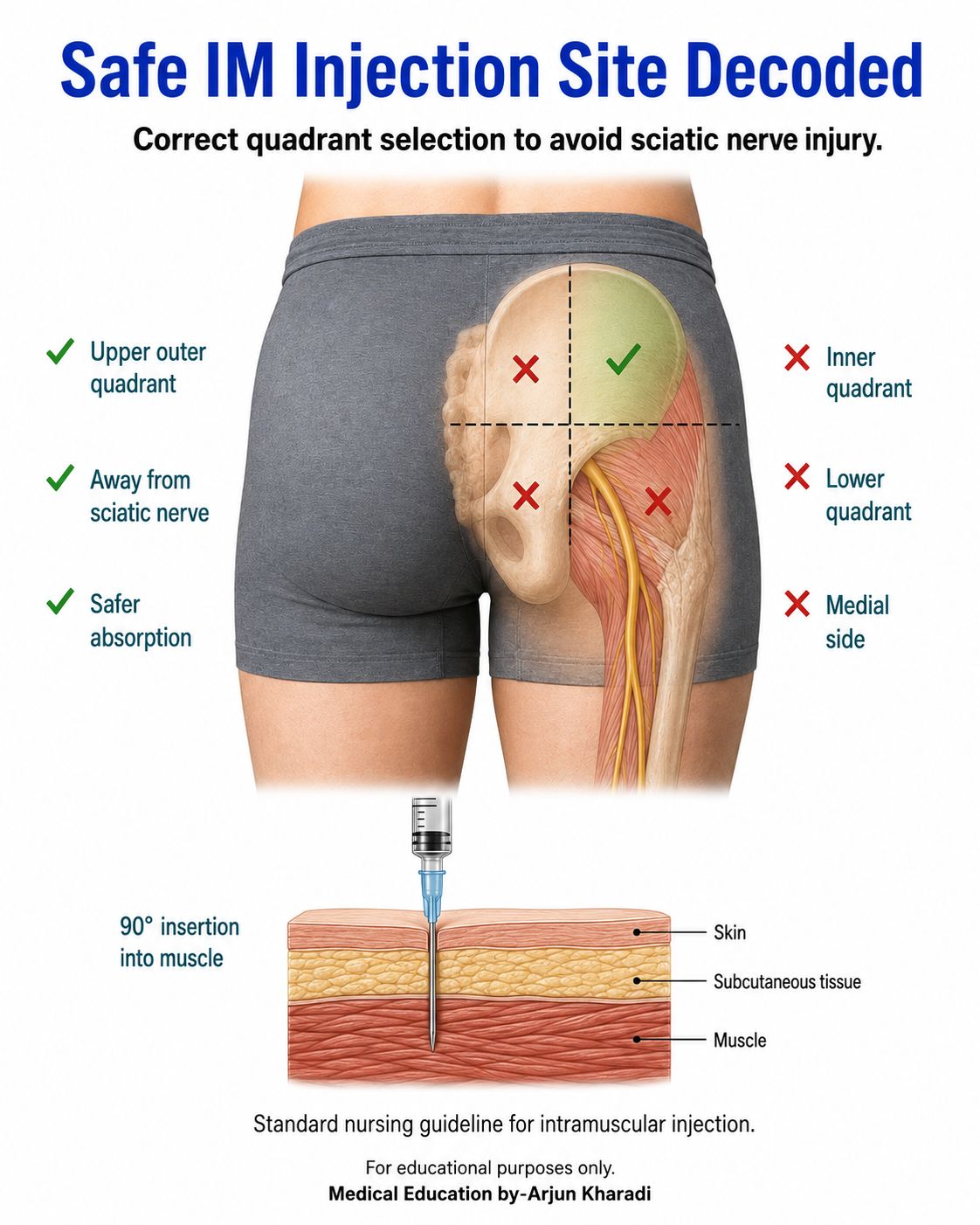 are b12 injections harmful buttocks Before giving an IM Dorsogluteal (buttocks) injection — read this carefully 👩🏽‍⚕️💉 The dorsogluteal site is high-risk if not done correctly, so technique matters. ✔️ After inserting the needle, aspir Vitamin B12 Injection Clinic
