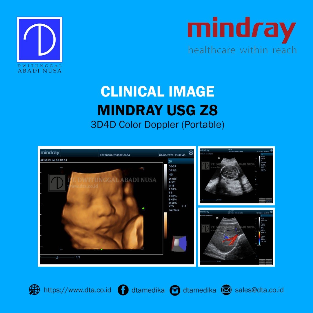 PT - Clinical Image Mindray USG Z8 - 3D/4D Portable Color Doppler. For ...