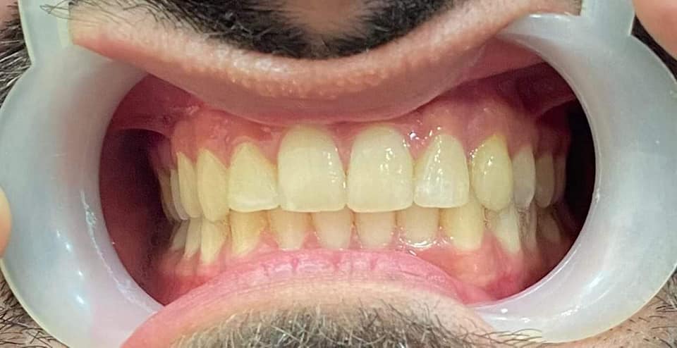 Dr. Rihal's Dental Clinic | Goraya