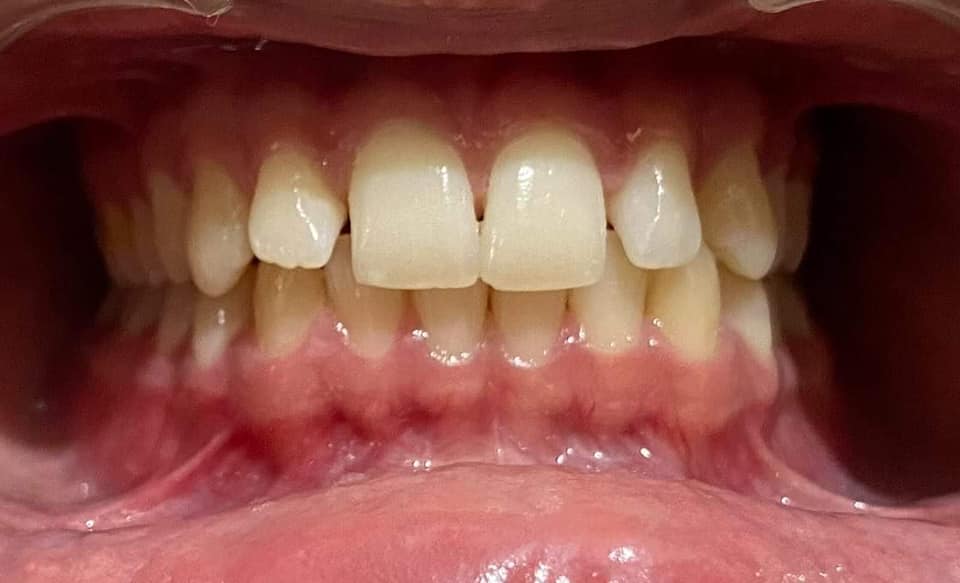 Dr. Rihal's Dental Clinic | Goraya