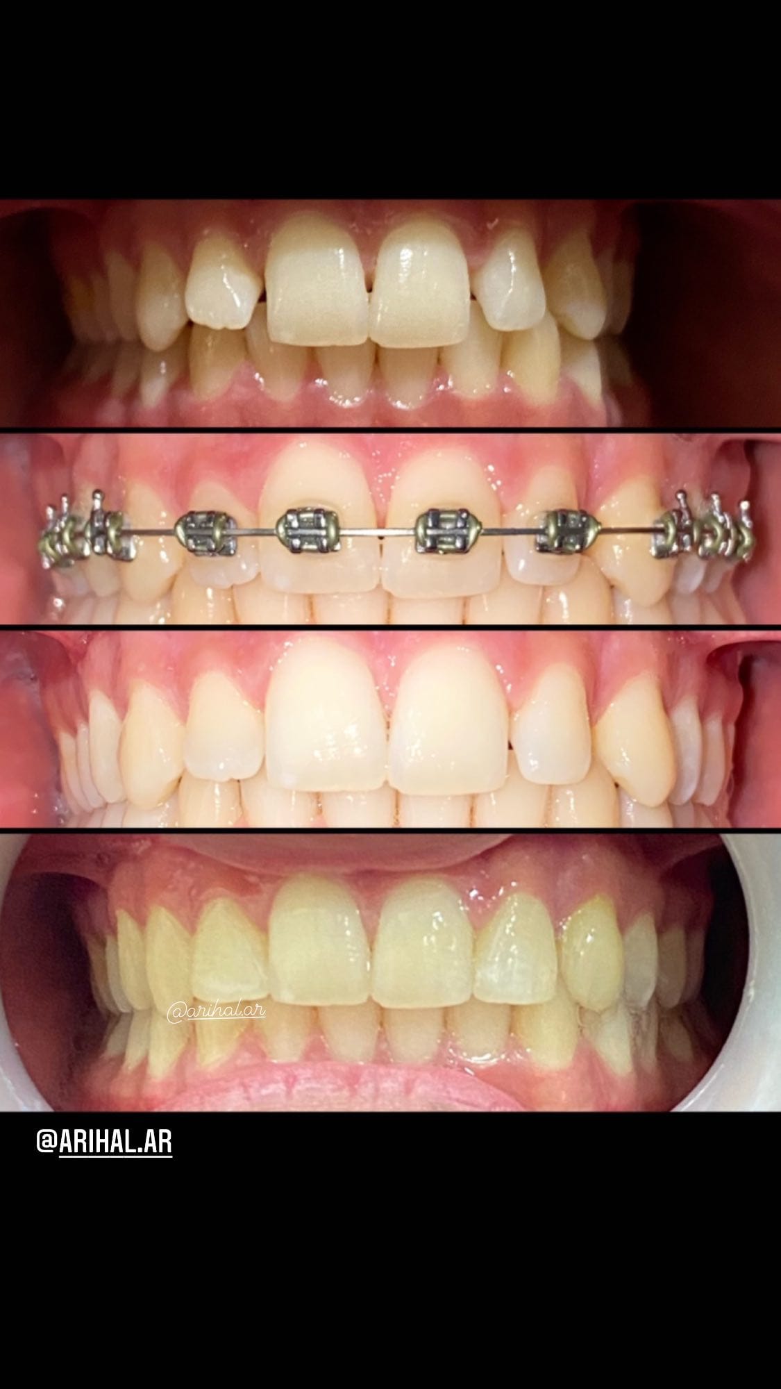 Dr. Rihal's Dental Clinic | Goraya