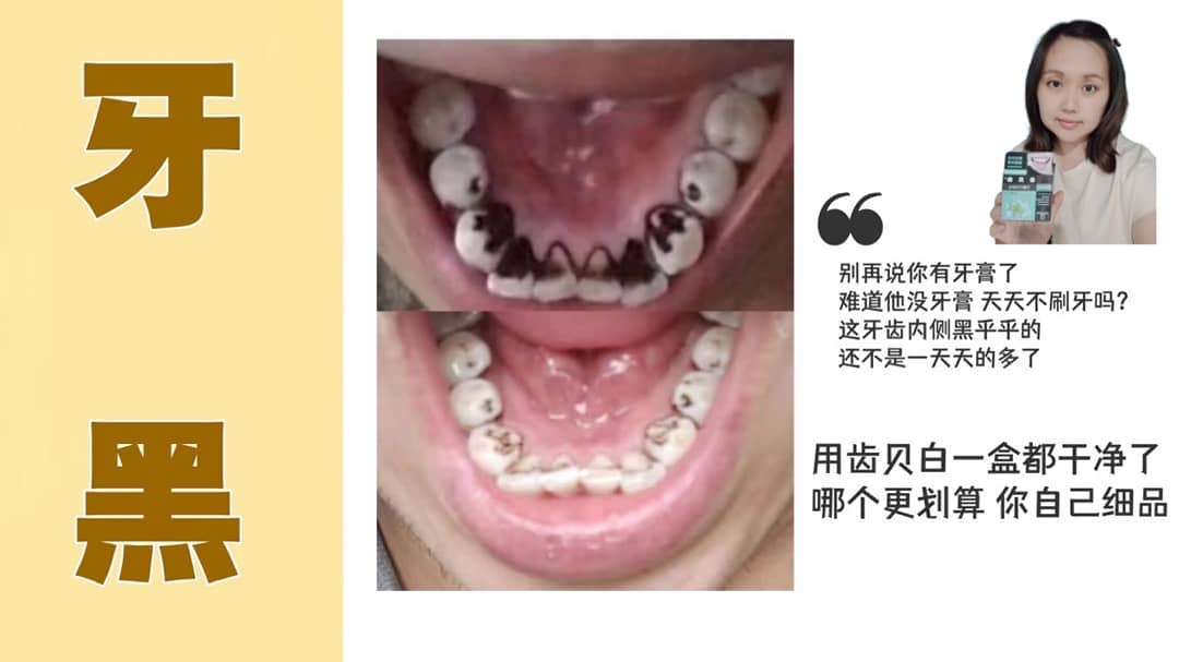 精灵店铺 用了几十年牙膏是真刷牙 还是被习惯忽悠了 既然齿贝白可以清干净牙齿我又何必将就齿贝白有效解决牙黄牙黑 Facebook