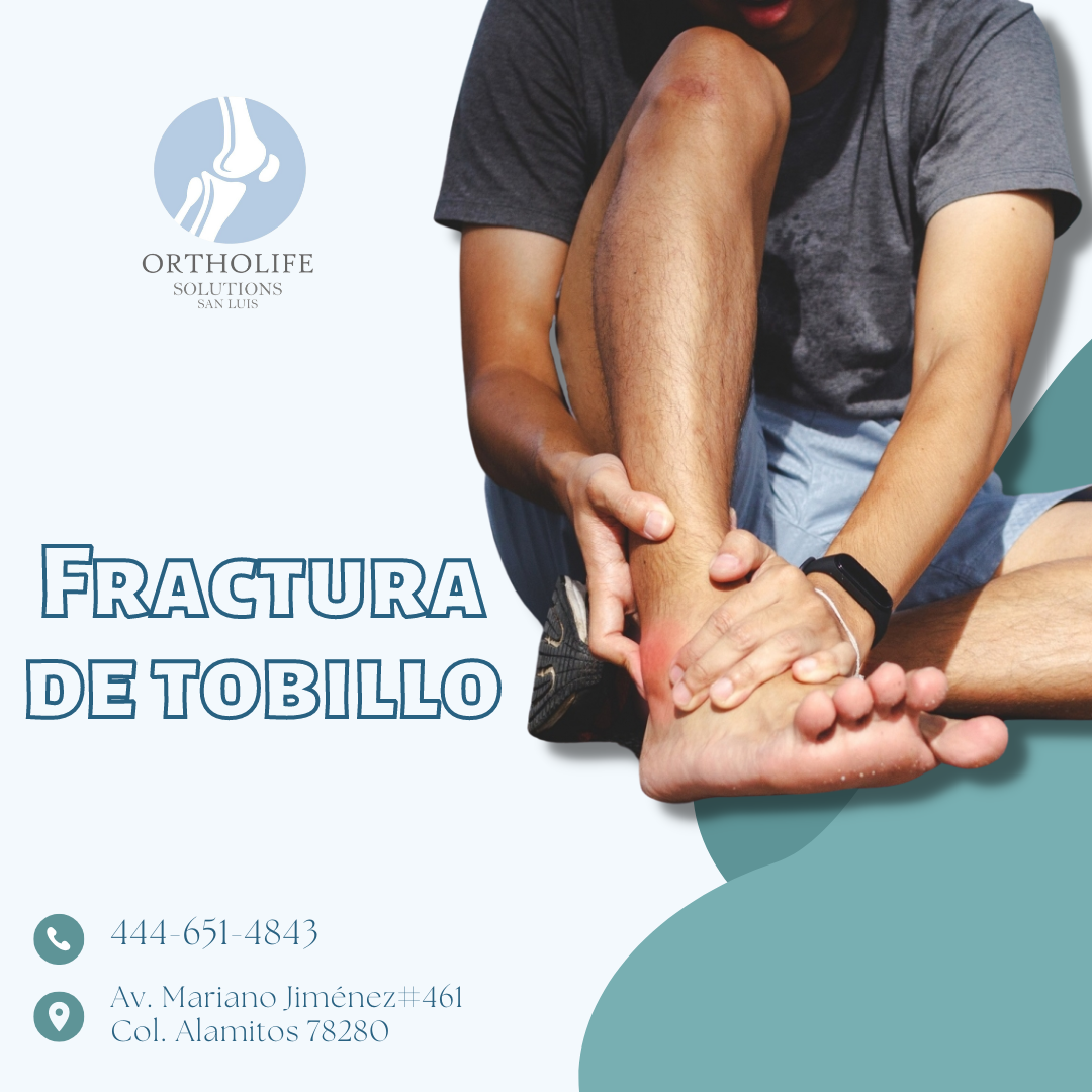Un tobillo roto o fracturado es una... - OrthoLife San Luis | Facebook