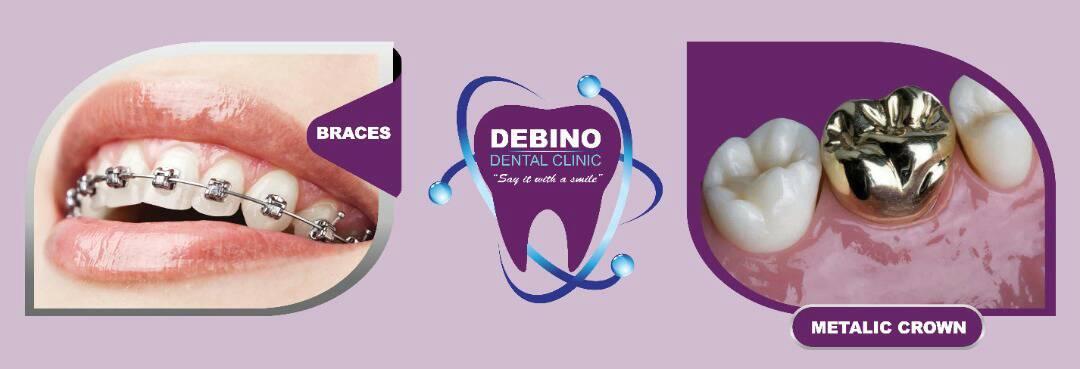 Debino Dental Clinic | Kisasi