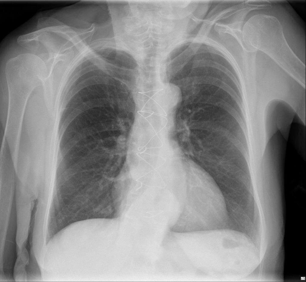 Radiology Signs - This patient had a wardrobe fall on him,... | Facebook
