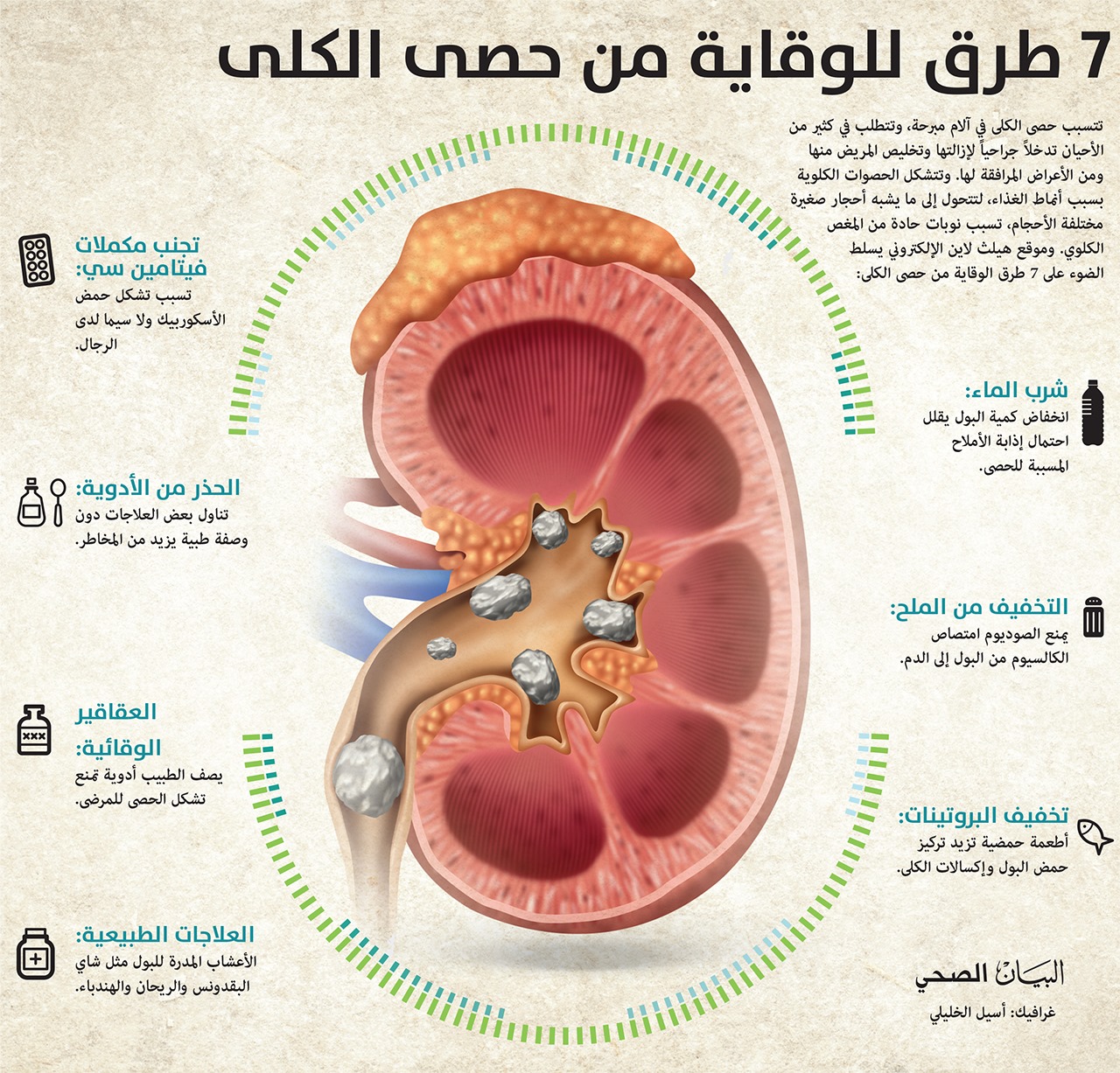4nono أعراض حصى الكلى 1 ألم في الظهر أو أحد الخواصر من أبرز أعراض حصى الكلى ألم الظهر والخواصر حيث لا يمكن الكشف عن وجود حصى في الكلى حتى يبدأ