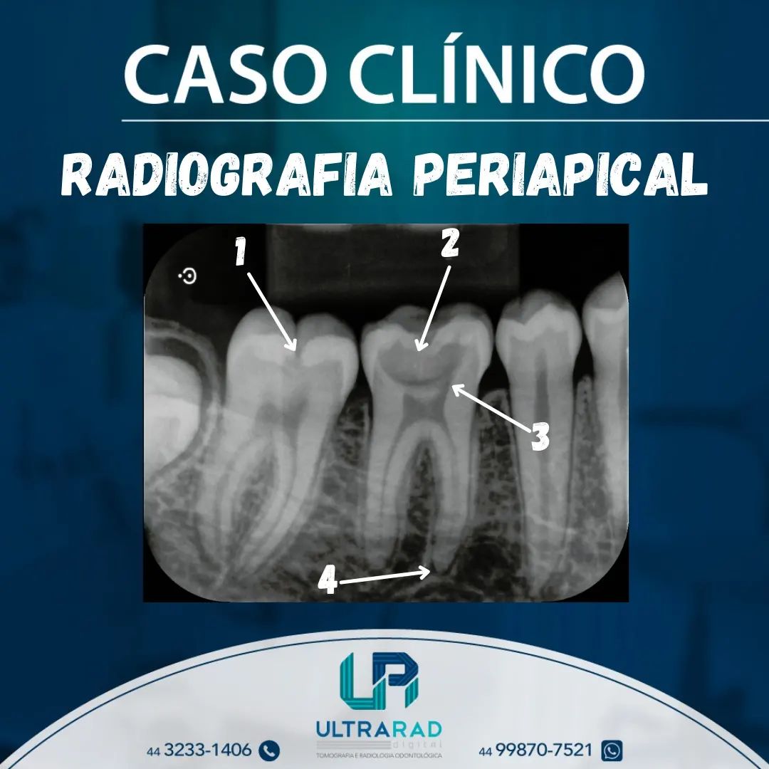 ☢️... - Ultrarad - Radiologia Odontológica Digital