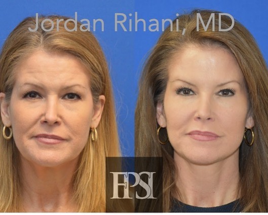 Happy to share this... - Facial Plastic Surgery Institute