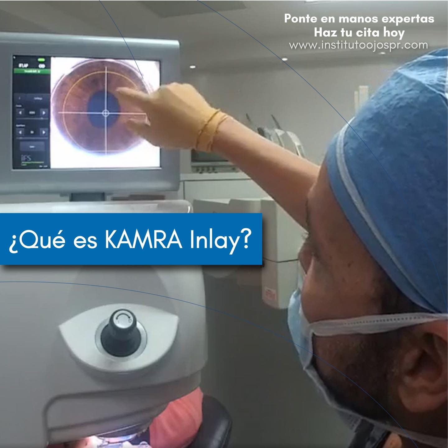 KAMRA Inlay es una cirugía del ojo que... - Instituto de Ojos