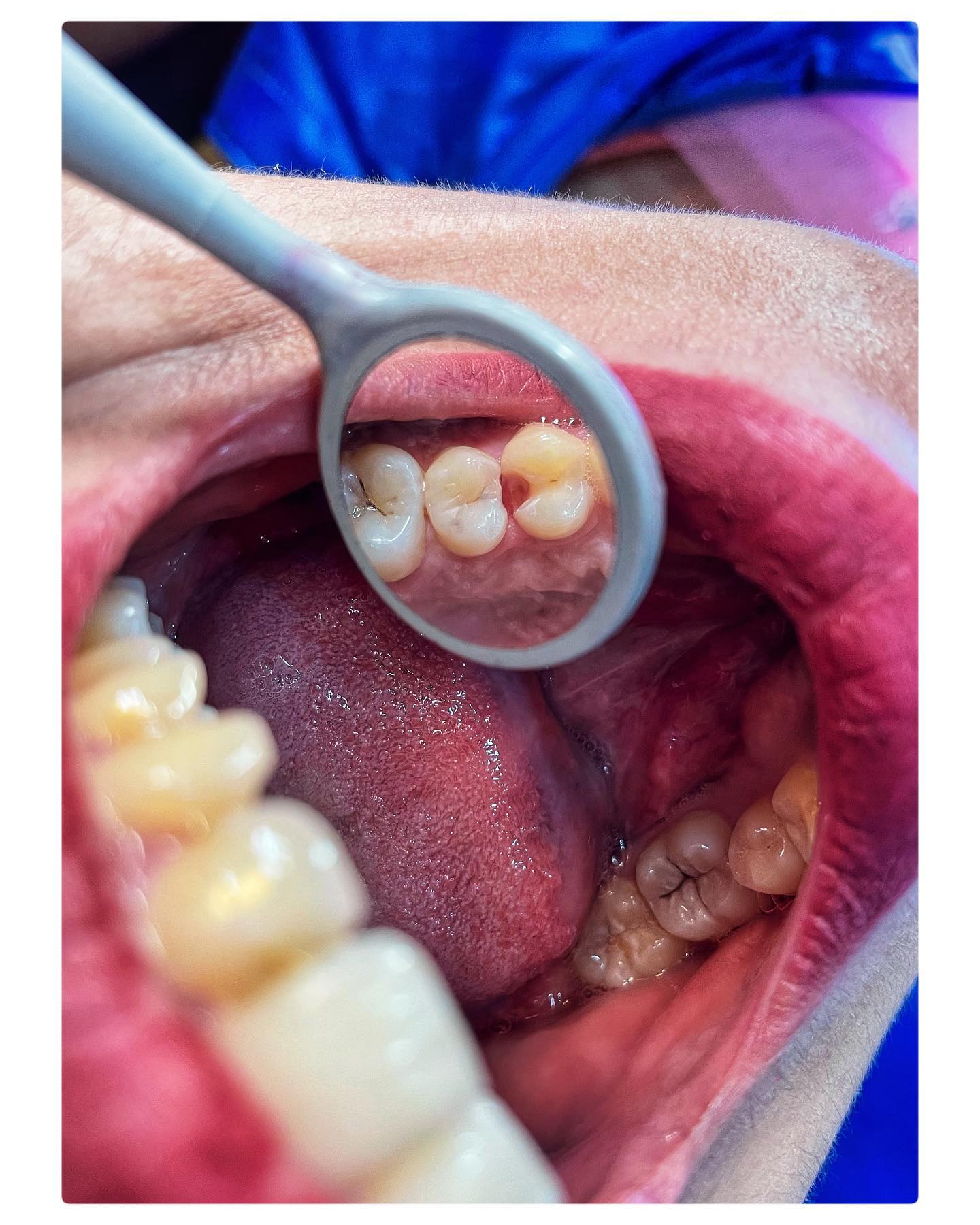 The Tooth Drive - What can be greater than restoring...