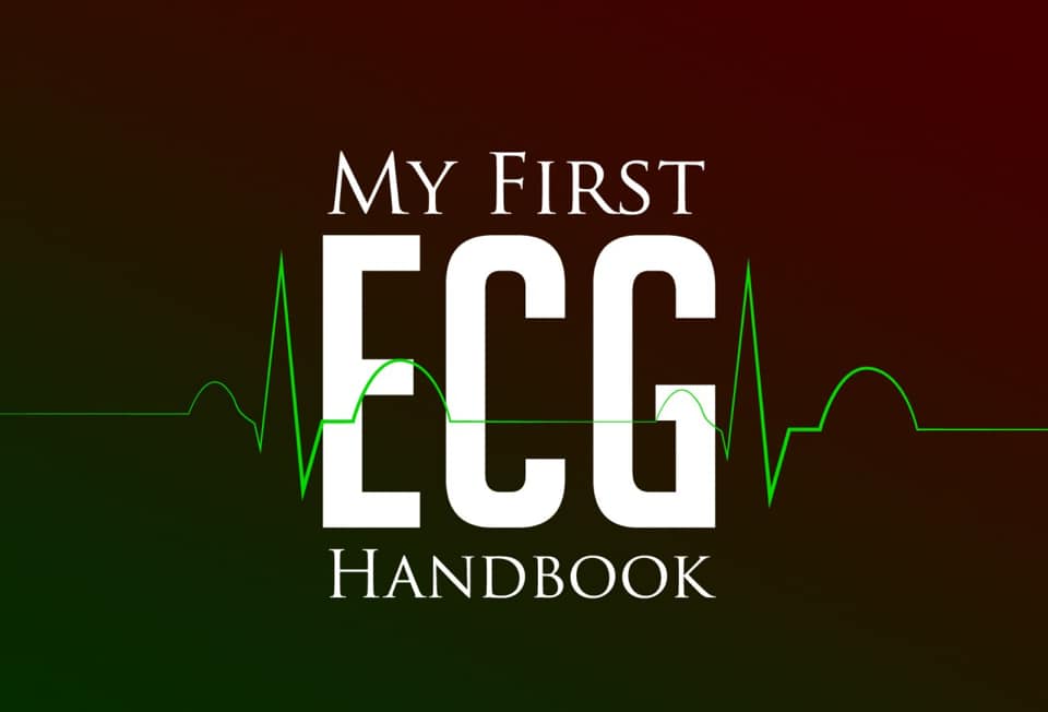 My First ECG Handbook