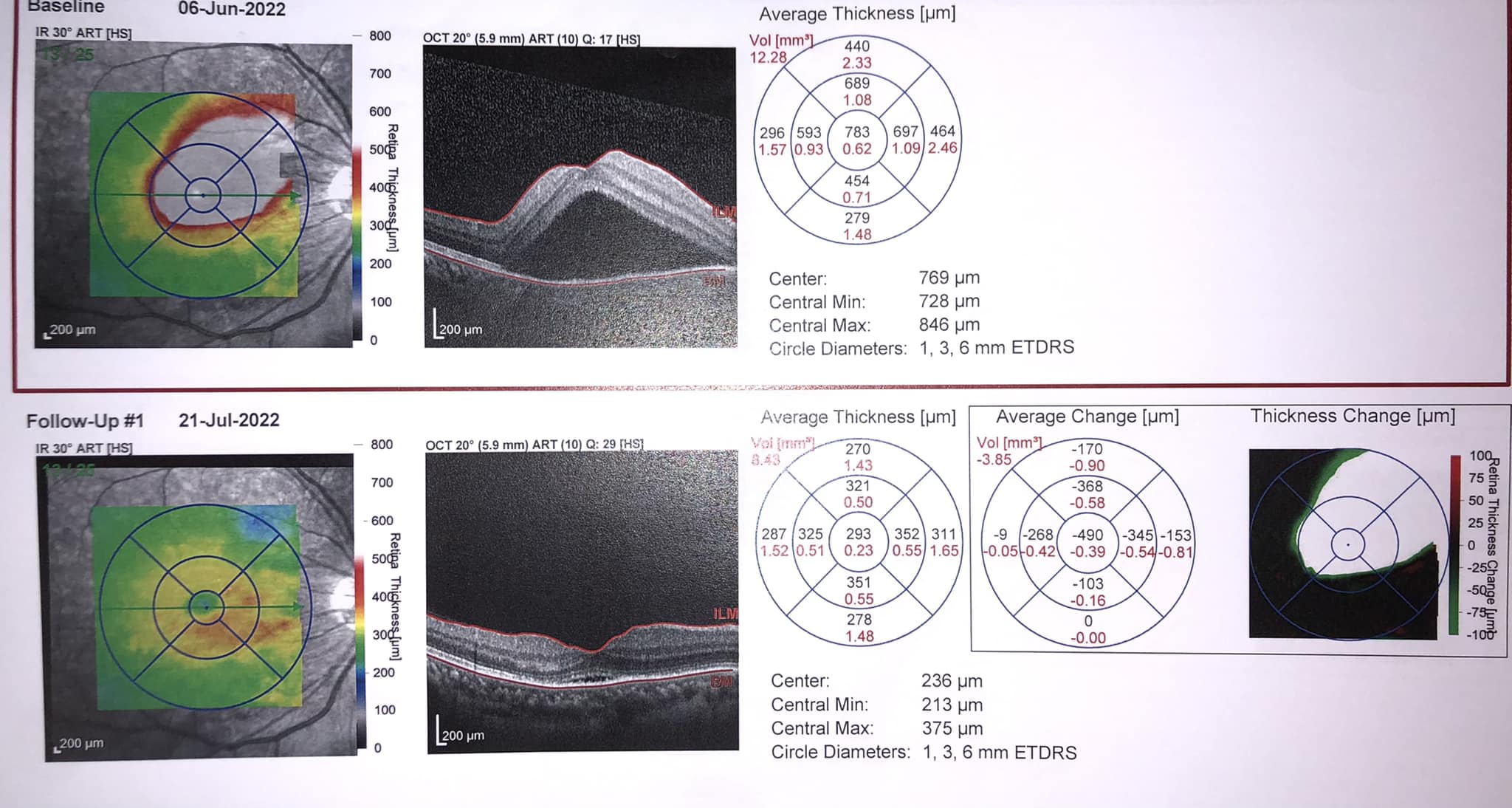 Dr. Sin Pui Yee Helena - Ophthalmologist 冼佩儀眼科專科醫生