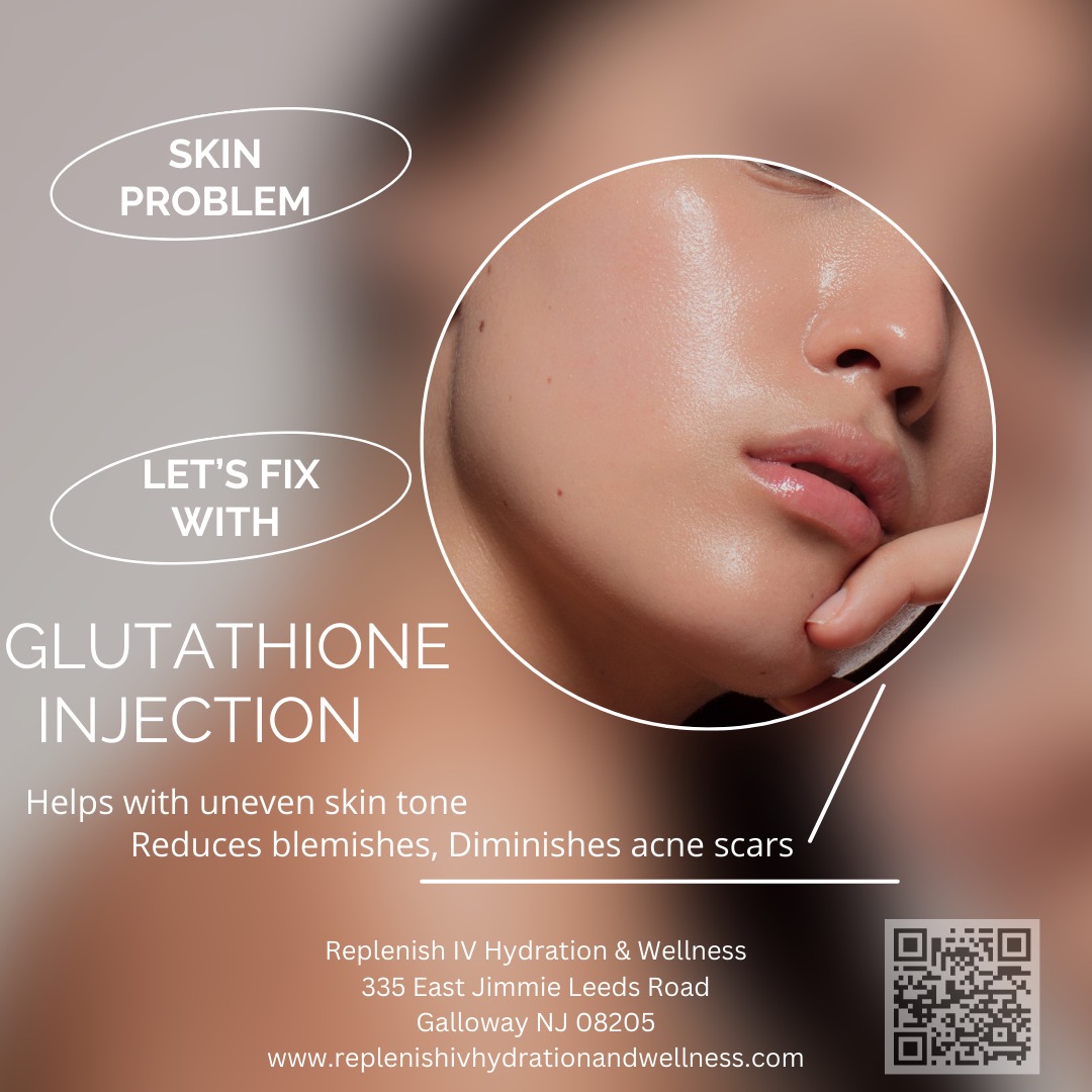 glutathione iv nj therapy Replenish IV Hydration & Wellness