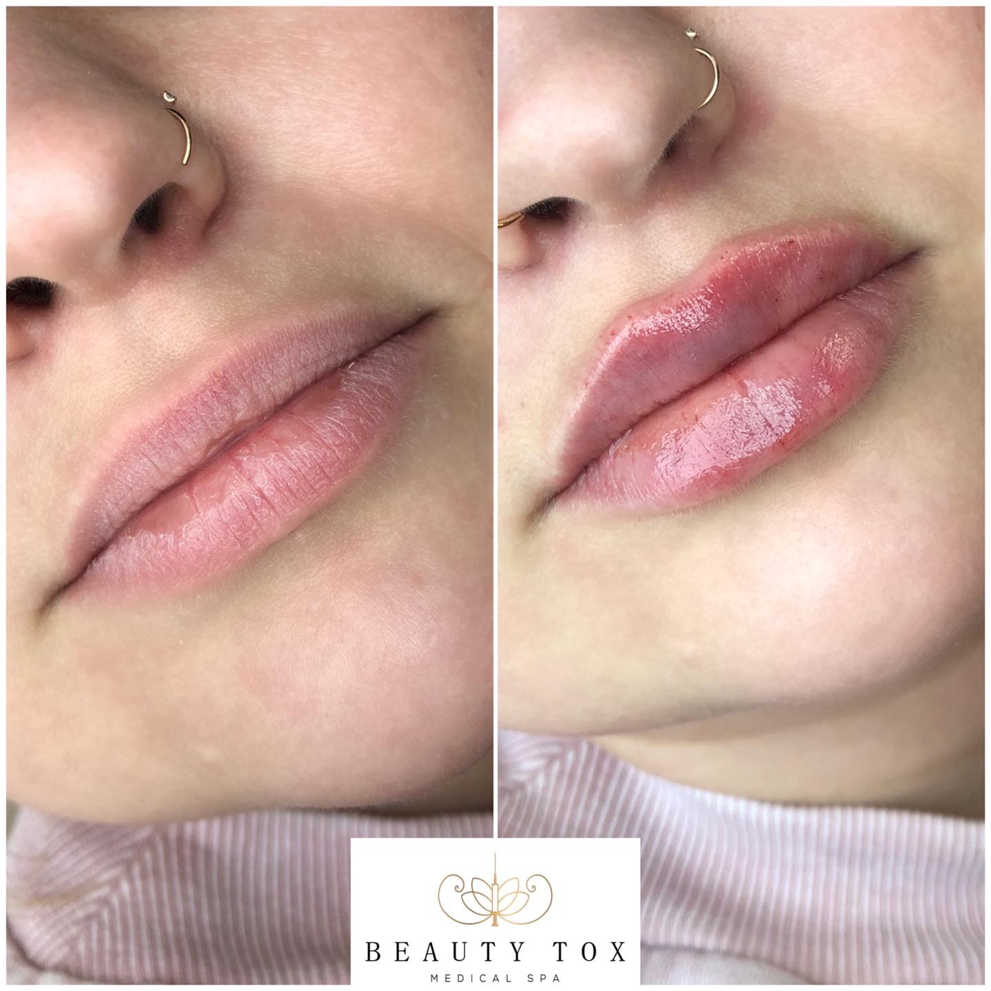 Beauty Tox Medical Spa Home Facebook