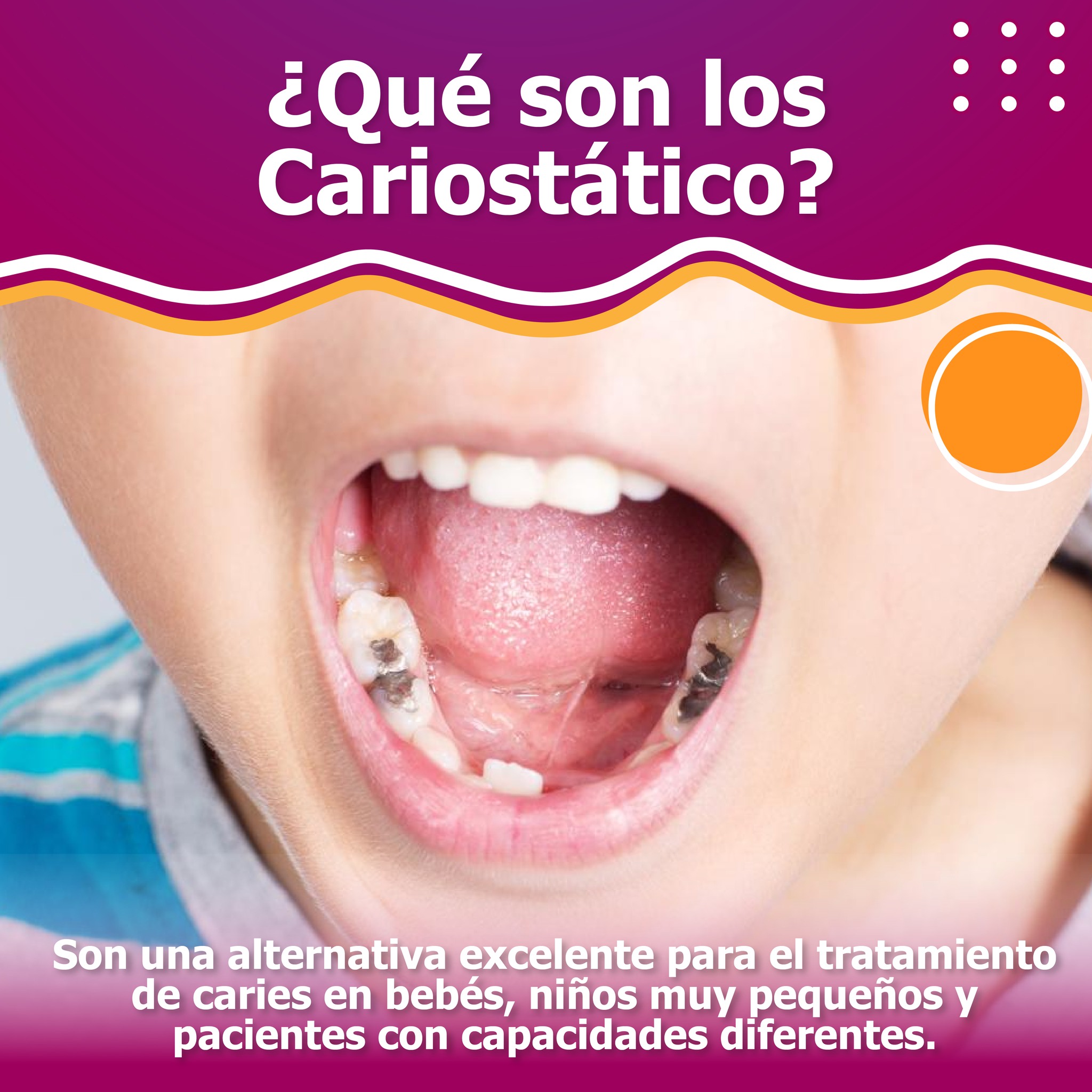 Centro - ️Los cariostáticos son agentes que inhiben la progresión de la ...