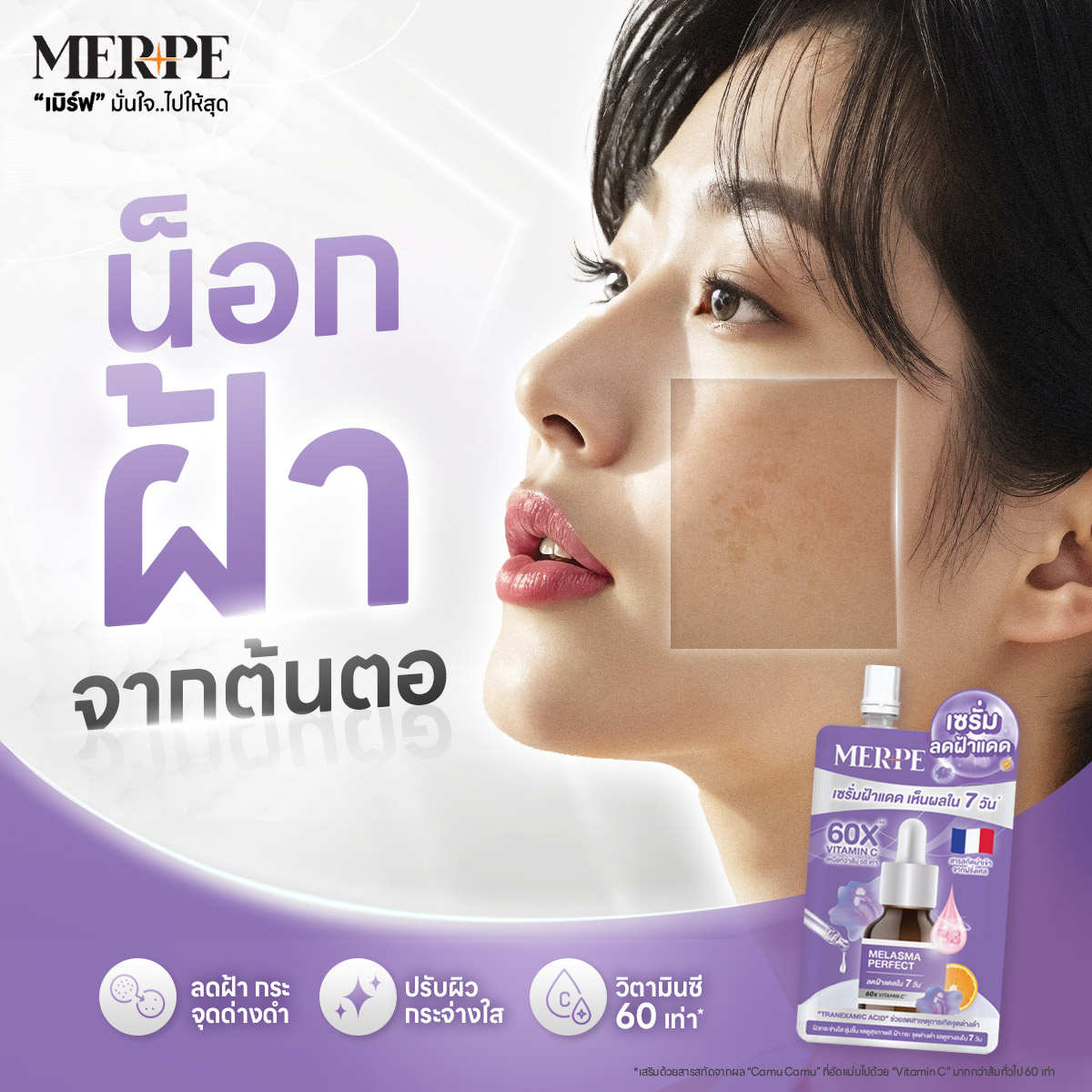 MERPE เมิร์ฟ - น็อกฝ้า บอกลากระ จุดด่างดำ🥊👋 ด้วย MELASMA... | Facebook