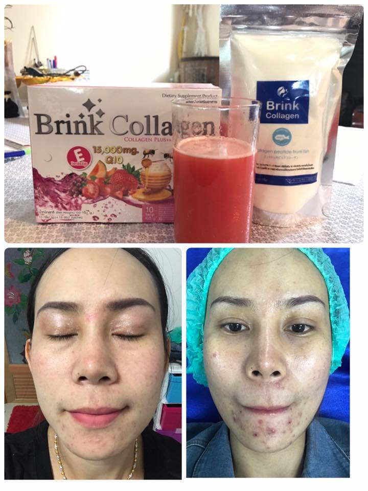 Brink Collagen