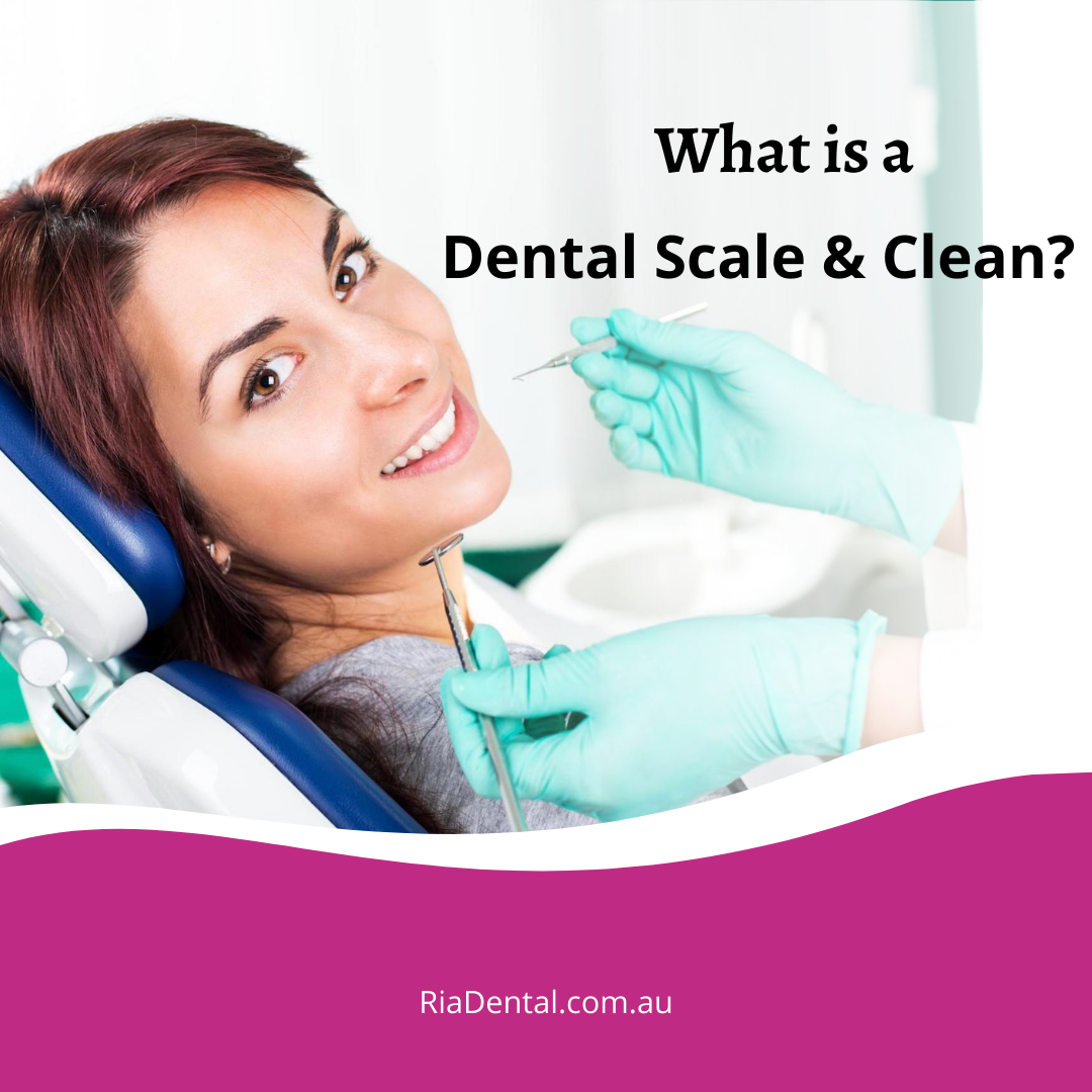 What Is a Dental Scale and Clean?... - Ria Family Dental | Facebook