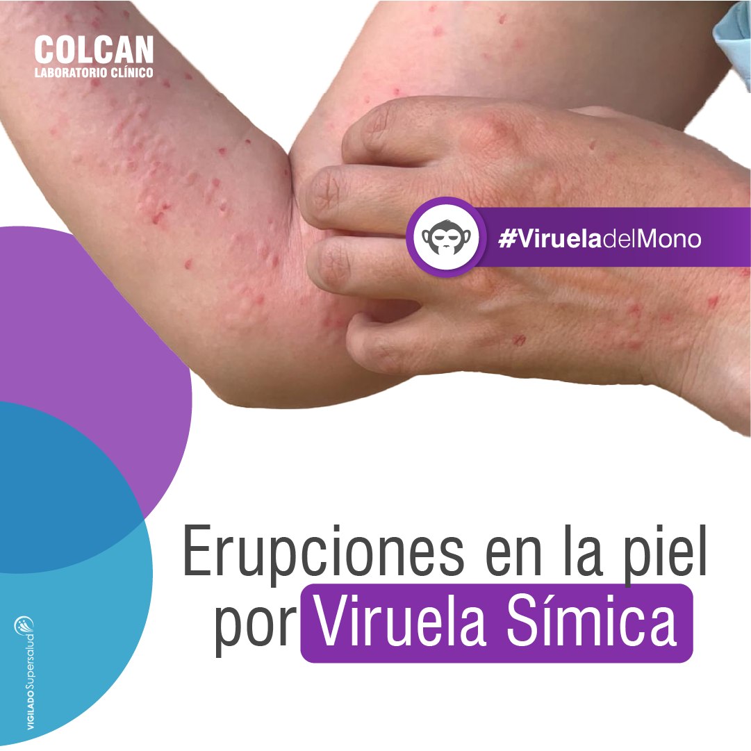 📢 Infórmate y conoce... - Laboratorio Clínico Colcan Colombia