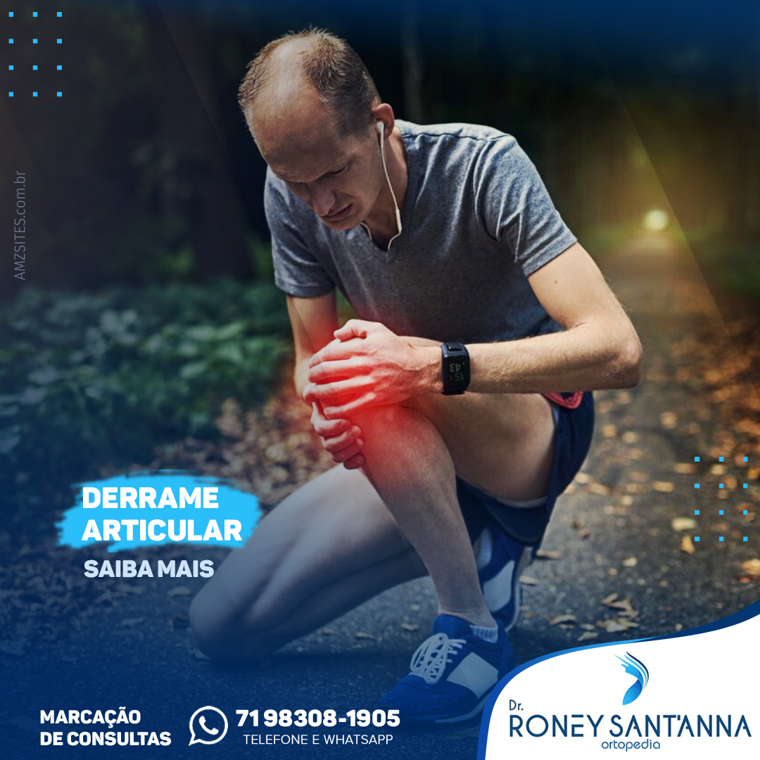 O derrame articular consiste no... - Dr. Roney Sant’Anna