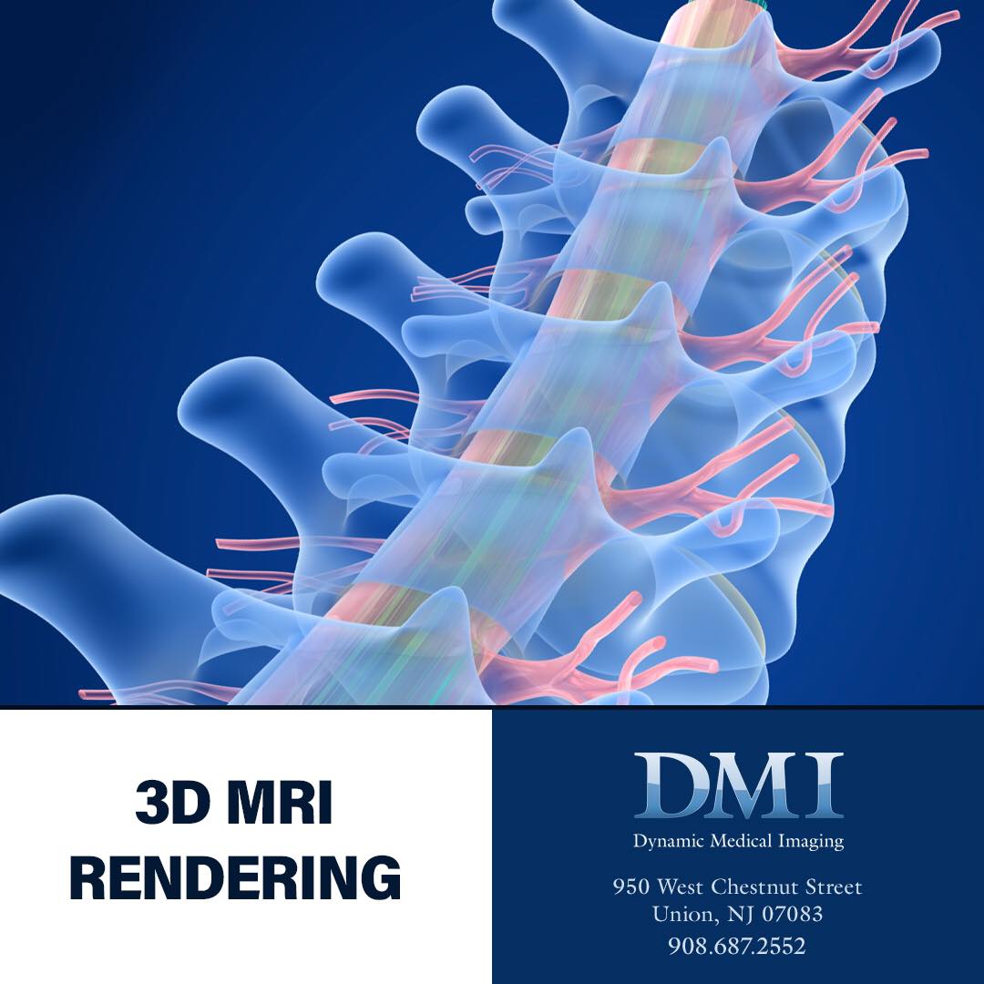 3D MRI Rendering is the creation... - Dynamic Medical Imaging | Facebook