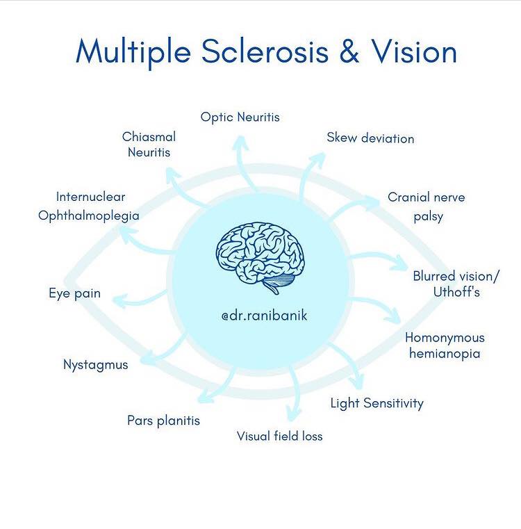 Multiple Sclerosis &... - Ophthalmology-Notes And Synopses