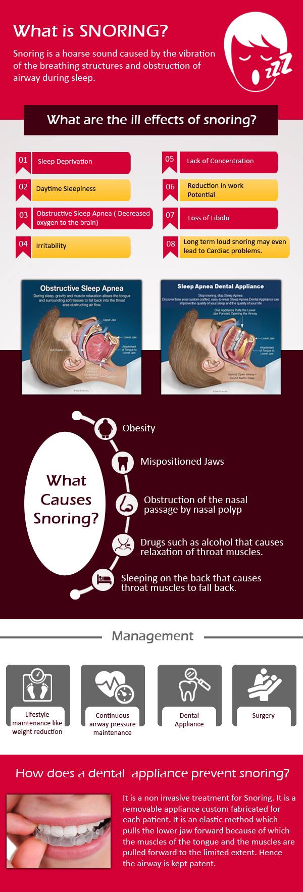 What is Snoring ? Infographic... - Imperial Dental Clinic | Facebook