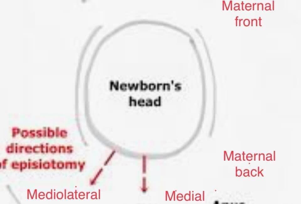 the-episiotomy-the-gynecology-obstetrics-digests-facebook