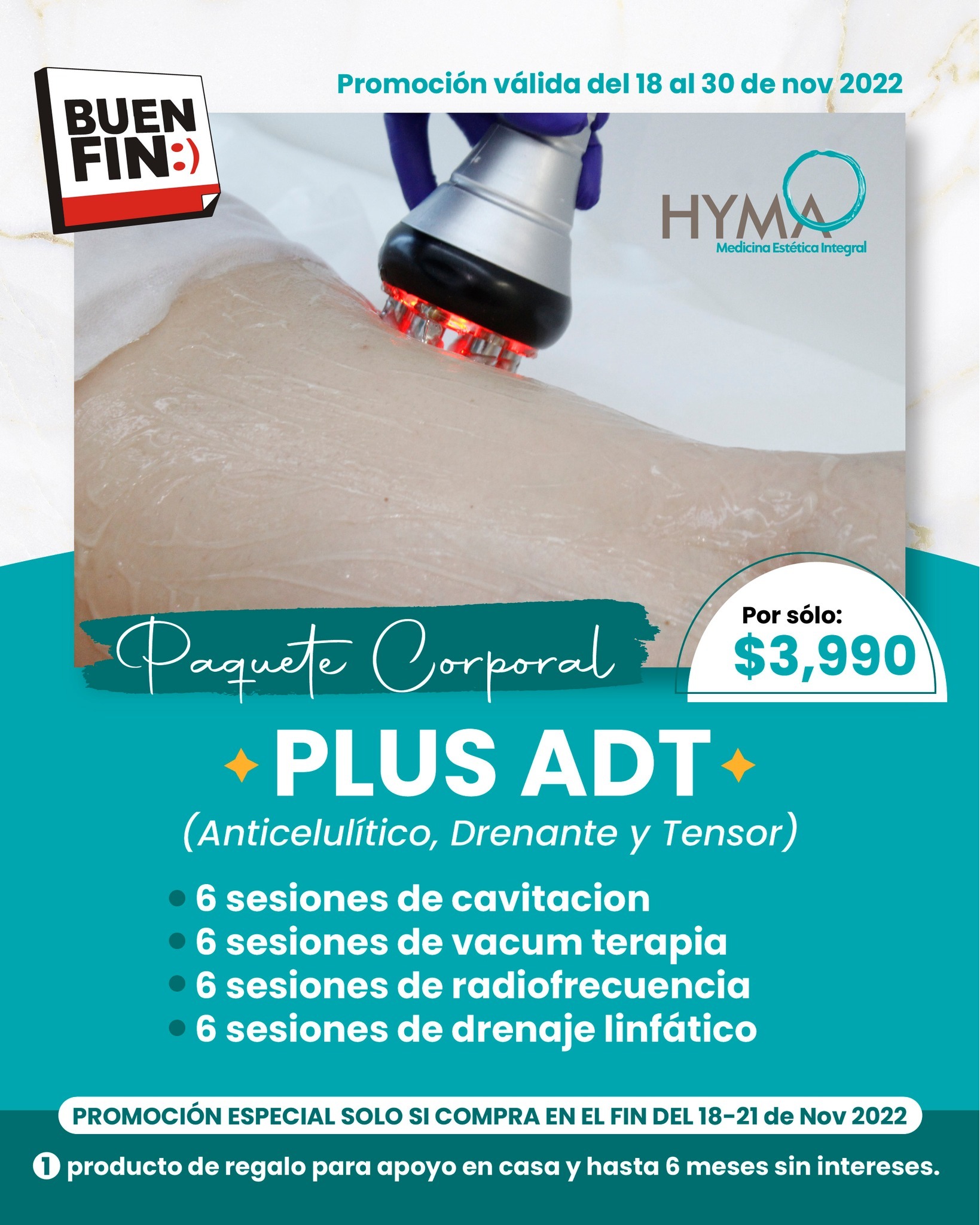 HYMA | Cuernavaca