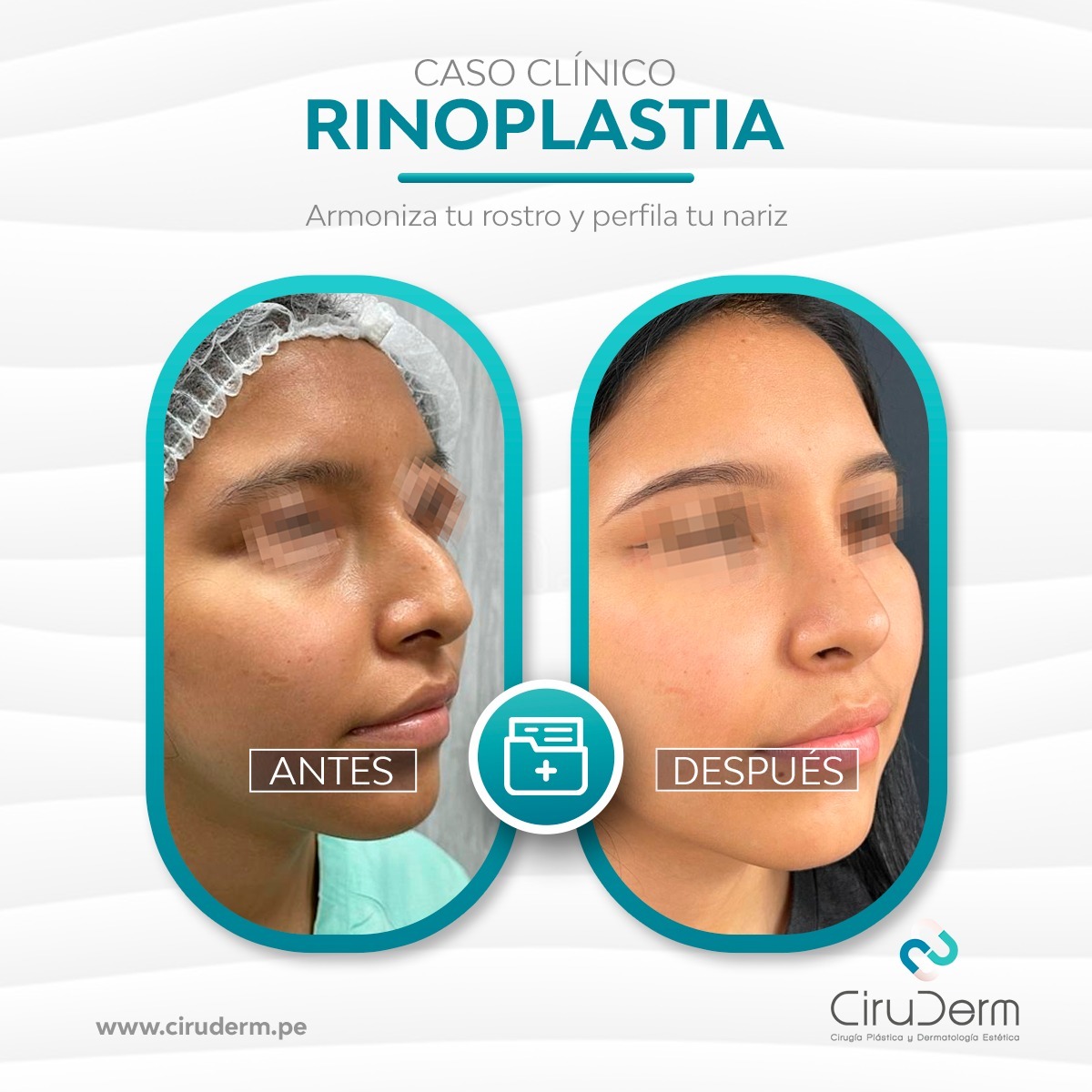 Ciruderm - ¡Los verdaderos cambios se ven en los... | Facebook