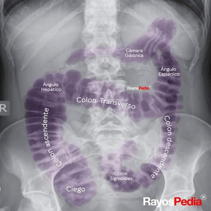 Mediclastos - 🔴 PATRÓN GASEOSO NORMAL EN RX DE ABDOMEN 👨‍⚕️📑 ...