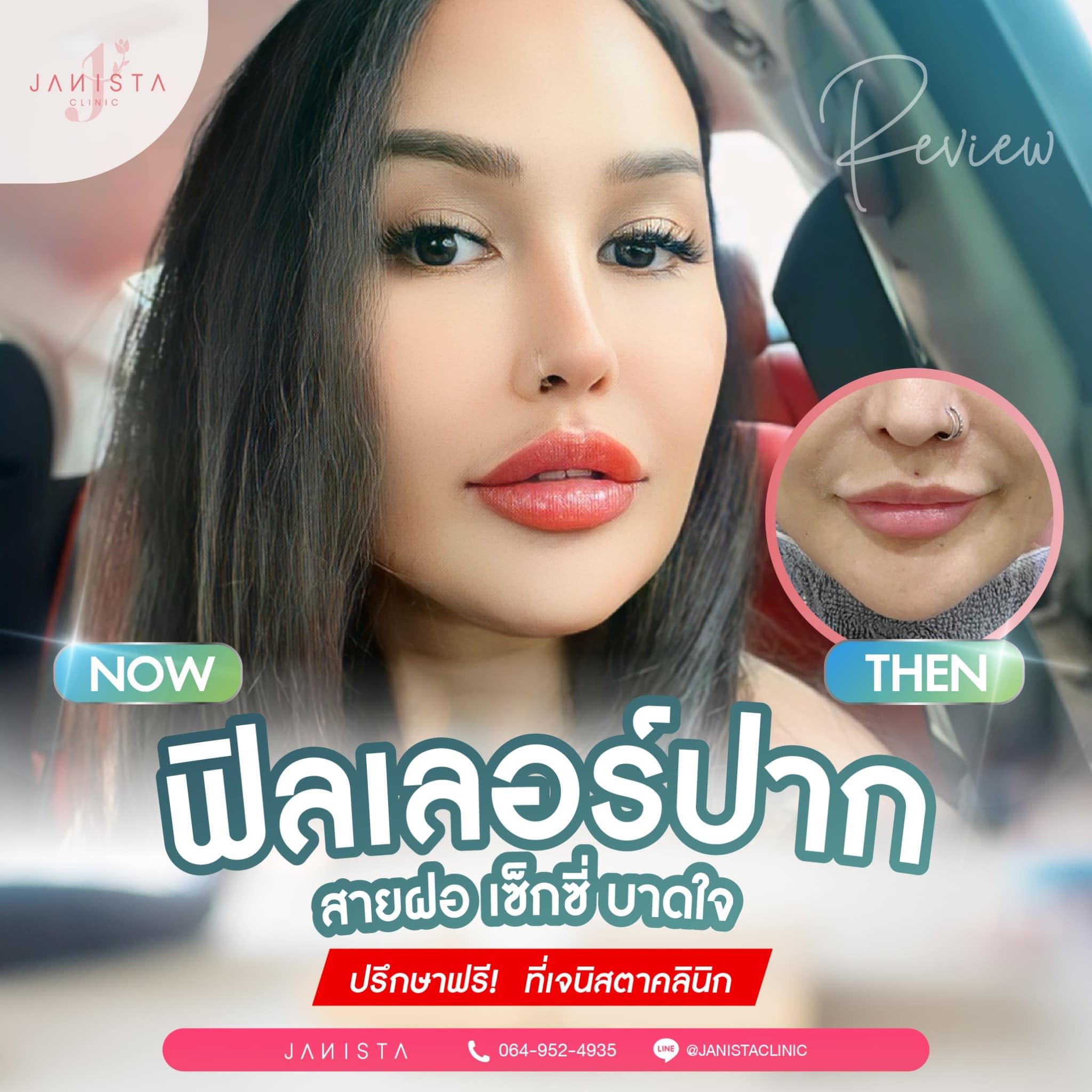 สวย..ขยี้ใจ!!!... - Janista Clinic - สาขาเชียงใหม่ | Facebook