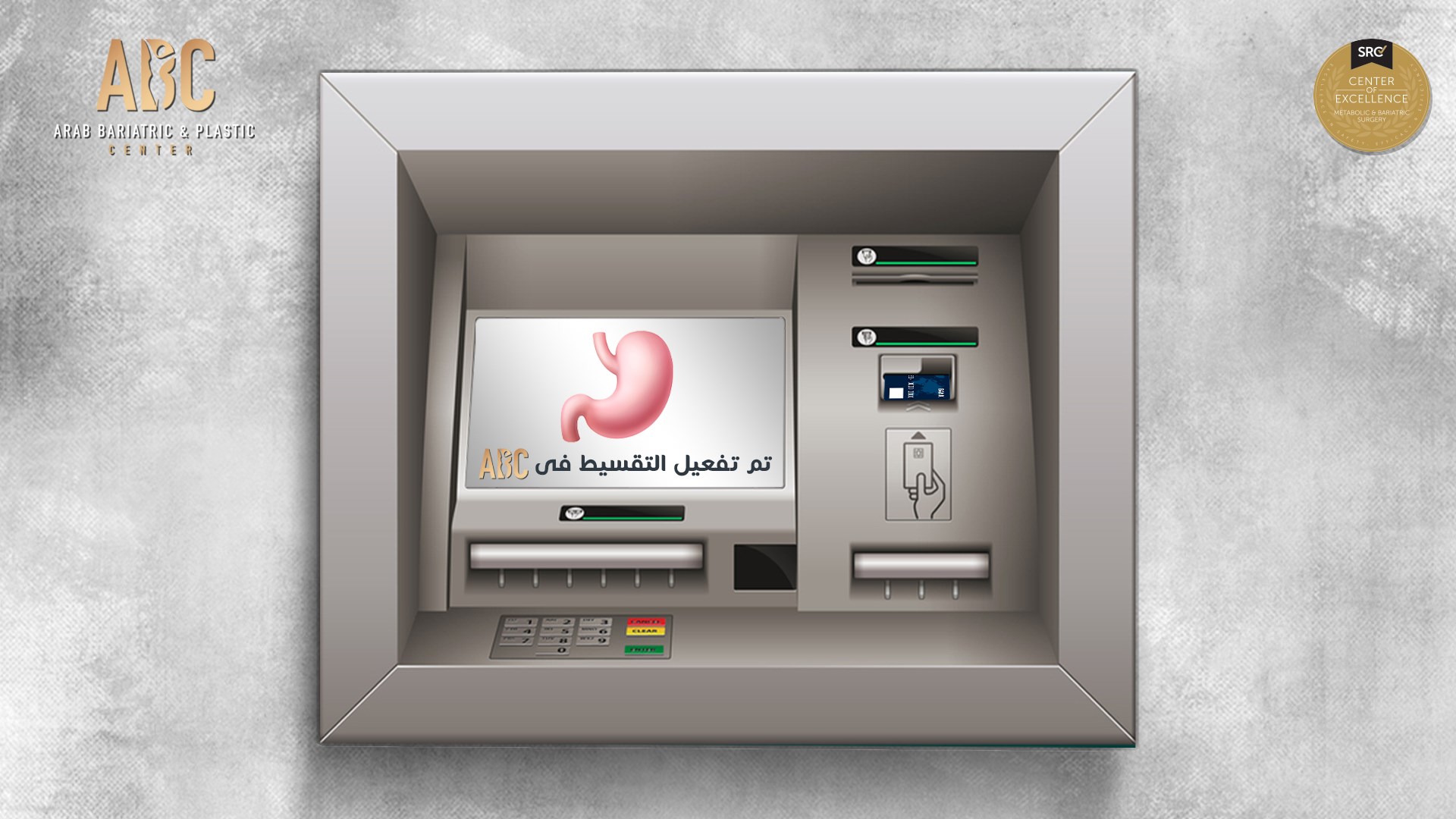 ABC Hospital - دلوقتي مع مستشفى ABC تقدر تقسط كل عمليات...