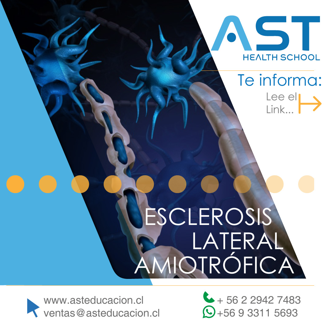 📢 AST Informa: 
